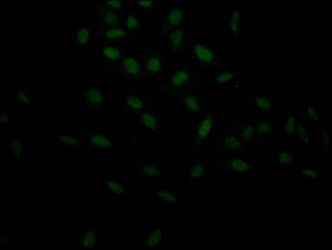 Immunofluorescence staining of Hela Cells with CSB-RA263943A0HU at 1:50, counter-stained with DAPI. The cells were fixed in 4% formaldehyde, permeated by 0.2% TritonX-100, and blocked in 10% normal Goat Serum. The cells were then incubated with the antibody overnight at 4℃. Nuclear DNA was labeled in blue with DAPI. The secondary antibody was FITC-conjugated AffiniPure Goat Anti-Rabbit IgG (H+L).