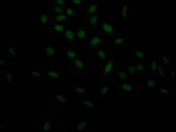 Immunofluorescence staining of Hela Cells with CSB-RA263943A0HU at 1:50, counter-stained with DAPI. The cells were fixed in 4% formaldehyde, permeated by 0.2% TritonX-100, and blocked in 10% normal Goat Serum. The cells were then incubated with the antibody overnight at 4℃. Nuclear DNA was labeled in blue with DAPI. The secondary antibody was FITC-conjugated AffiniPure Goat Anti-Rabbit IgG (H+L).