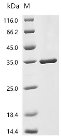 (Tris-Glycine gel) Discontinuous SDS-PAGE (reduced) with 5% enrichment gel and 15% separation gel.