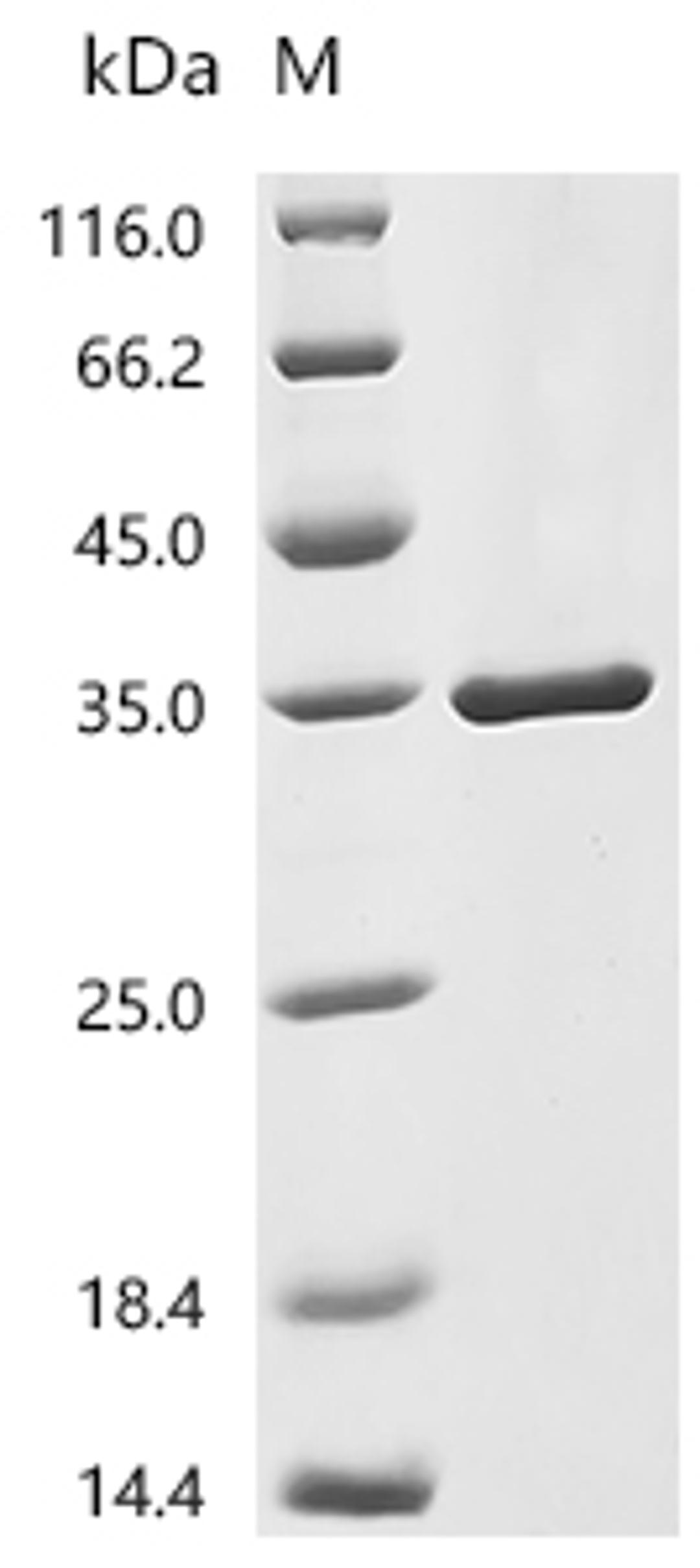 (Tris-Glycine gel) Discontinuous SDS-PAGE (reduced) with 5% enrichment gel and 15% separation gel.