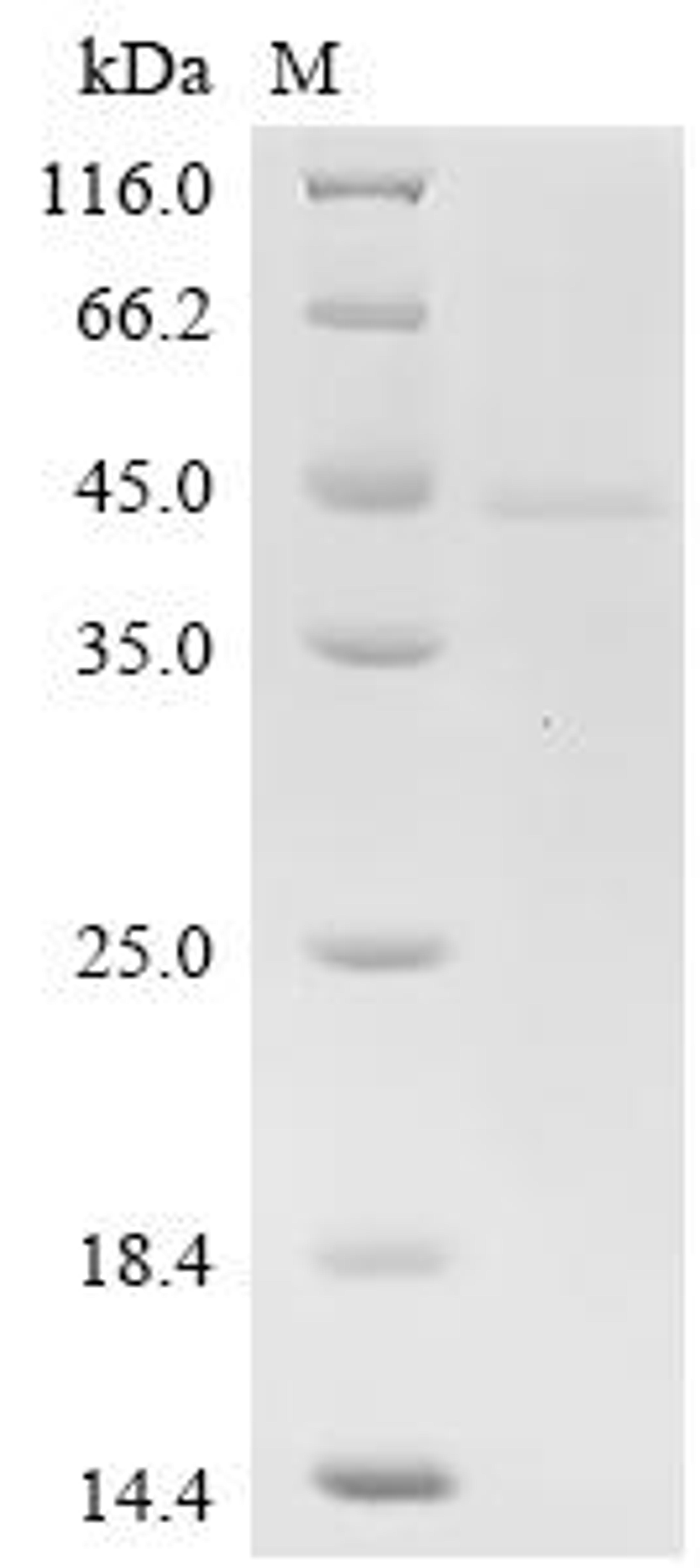 (Tris-Glycine gel) Discontinuous SDS-PAGE (reduced) with 5% enrichment gel and 15% separation gel.
