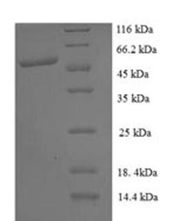 (Tris-Glycine gel) Discontinuous SDS-PAGE (reduced) with 5% enrichment gel and 15% separation gel.