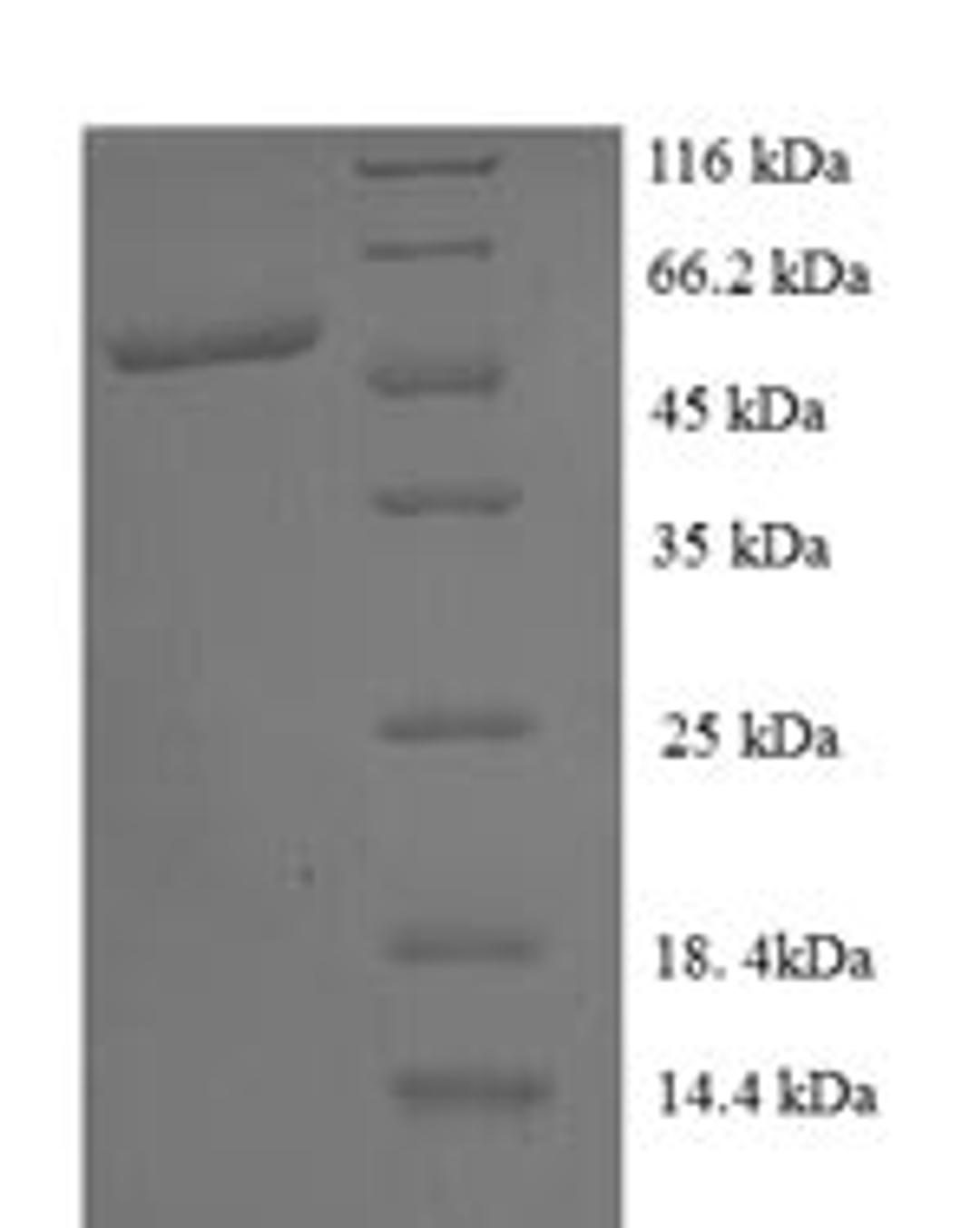 (Tris-Glycine gel) Discontinuous SDS-PAGE (reduced) with 5% enrichment gel and 15% separation gel.