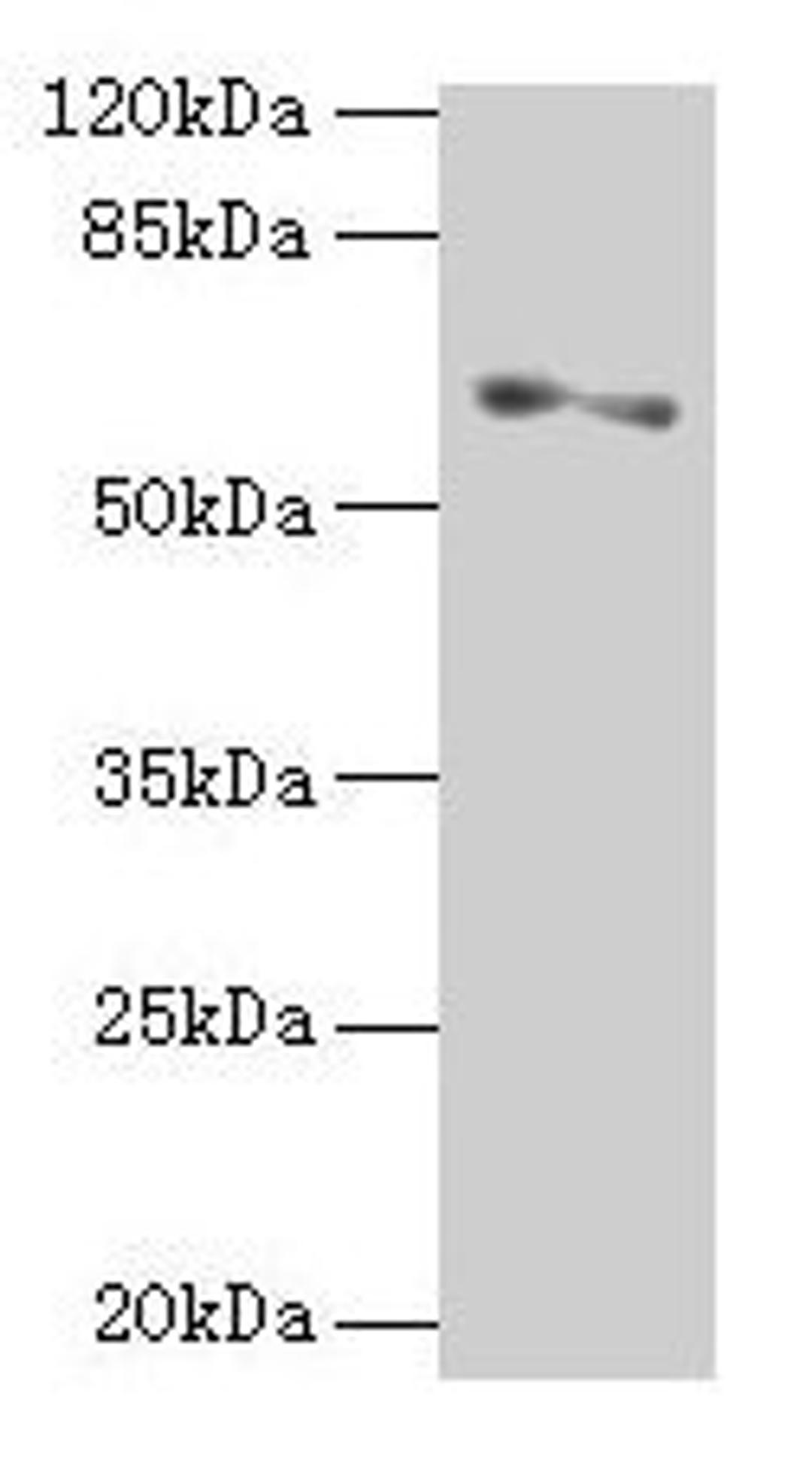 Western blot. All lanes: SLC1A6 antibody at 2µg/ml + A375 whole cell lysate. Secondary. Goat polyclonal to rabbit IgG at 1/10000 dilution. Predicted band size: 62, 35 kDa. Observed band size: 62 kDa