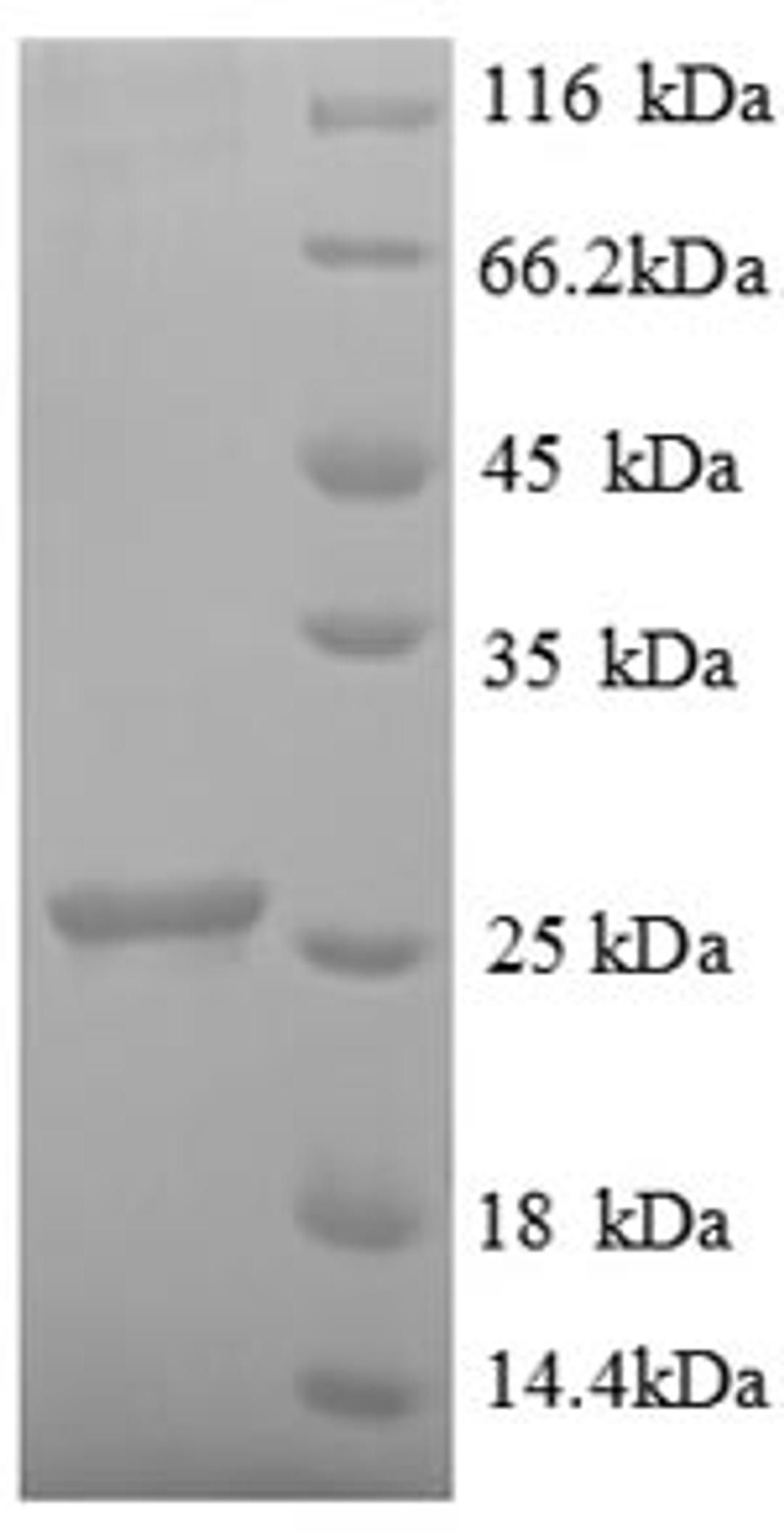(Tris-Glycine gel) Discontinuous SDS-PAGE (reduced) with 5% enrichment gel and 15% separation gel.