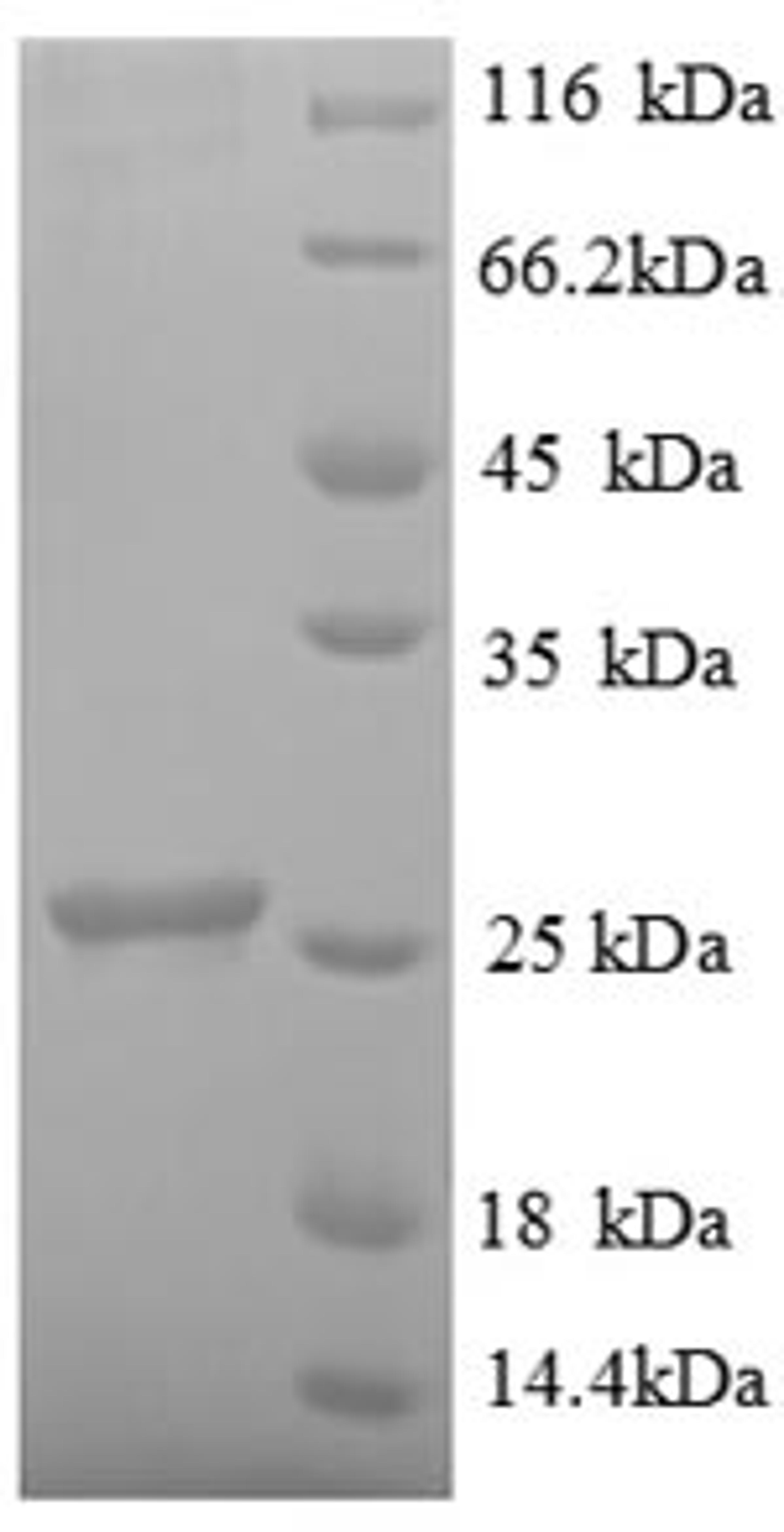 (Tris-Glycine gel) Discontinuous SDS-PAGE (reduced) with 5% enrichment gel and 15% separation gel.