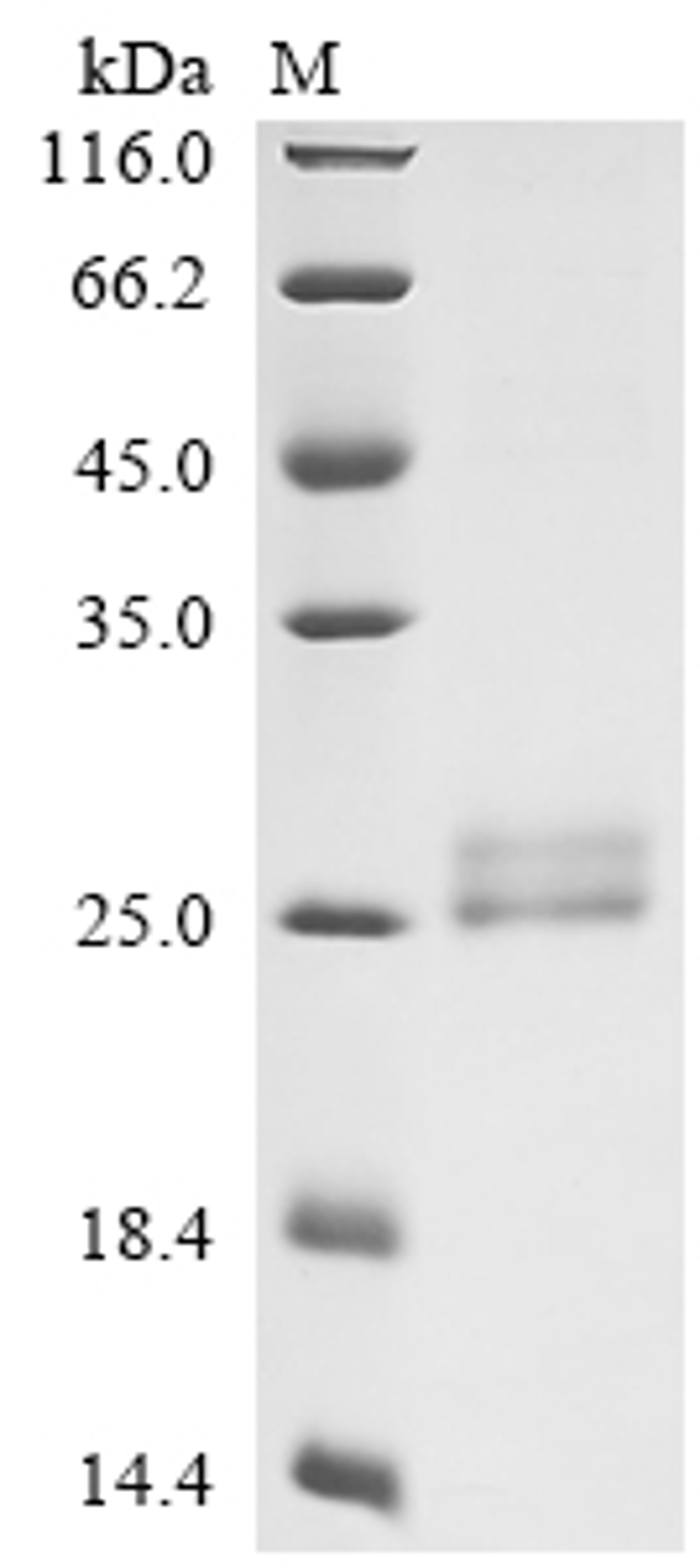(Tris-Glycine gel) Discontinuous SDS-PAGE (reduced) with 5% enrichment gel and 15% separation gel.