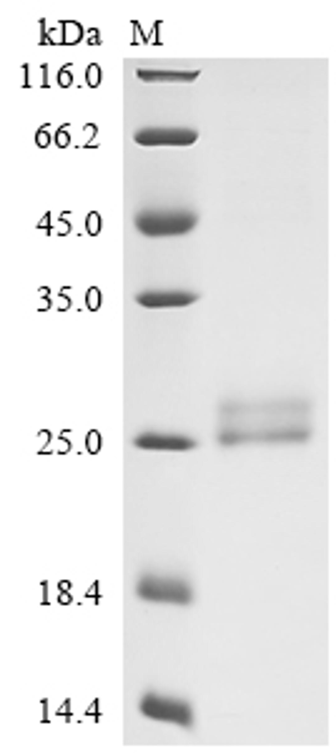 (Tris-Glycine gel) Discontinuous SDS-PAGE (reduced) with 5% enrichment gel and 15% separation gel.