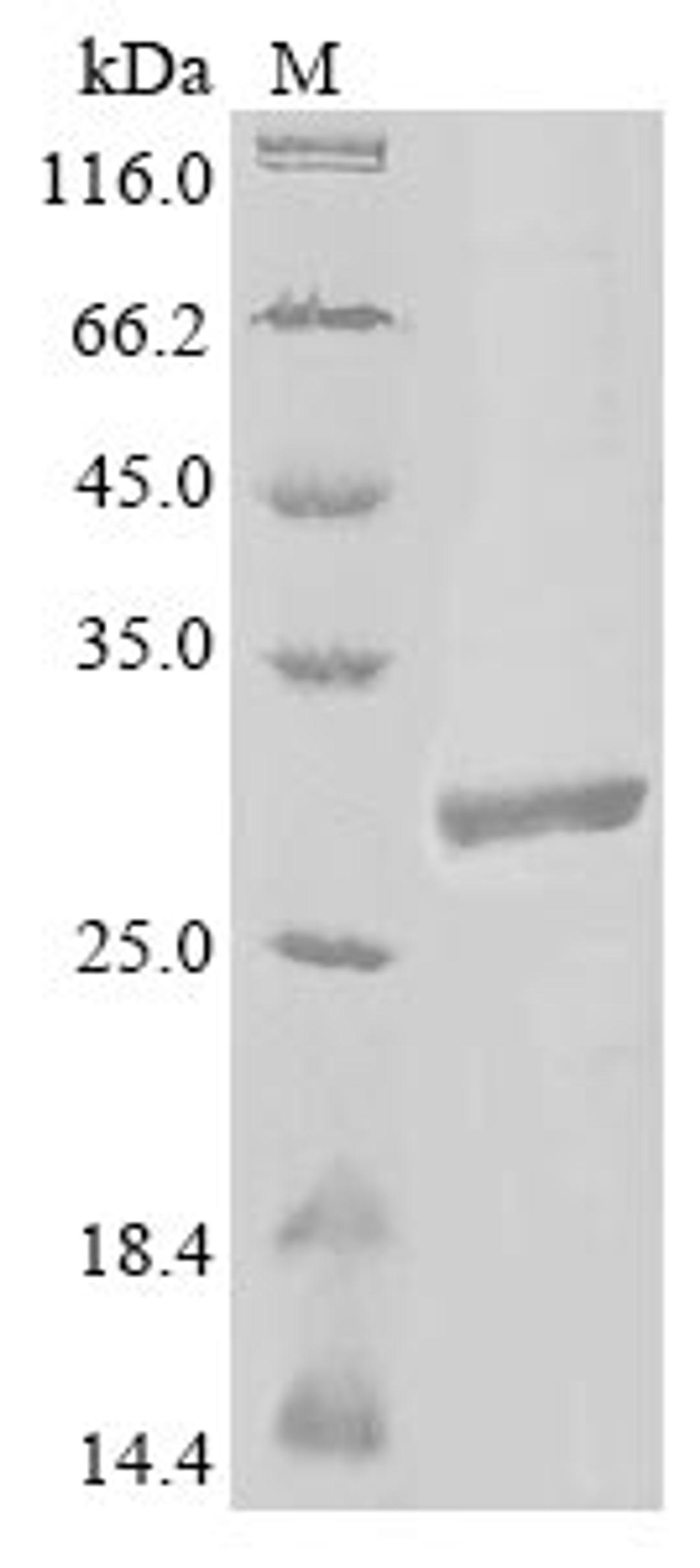 (Tris-Glycine gel) Discontinuous SDS-PAGE (reduced) with 5% enrichment gel and 15% separation gel.