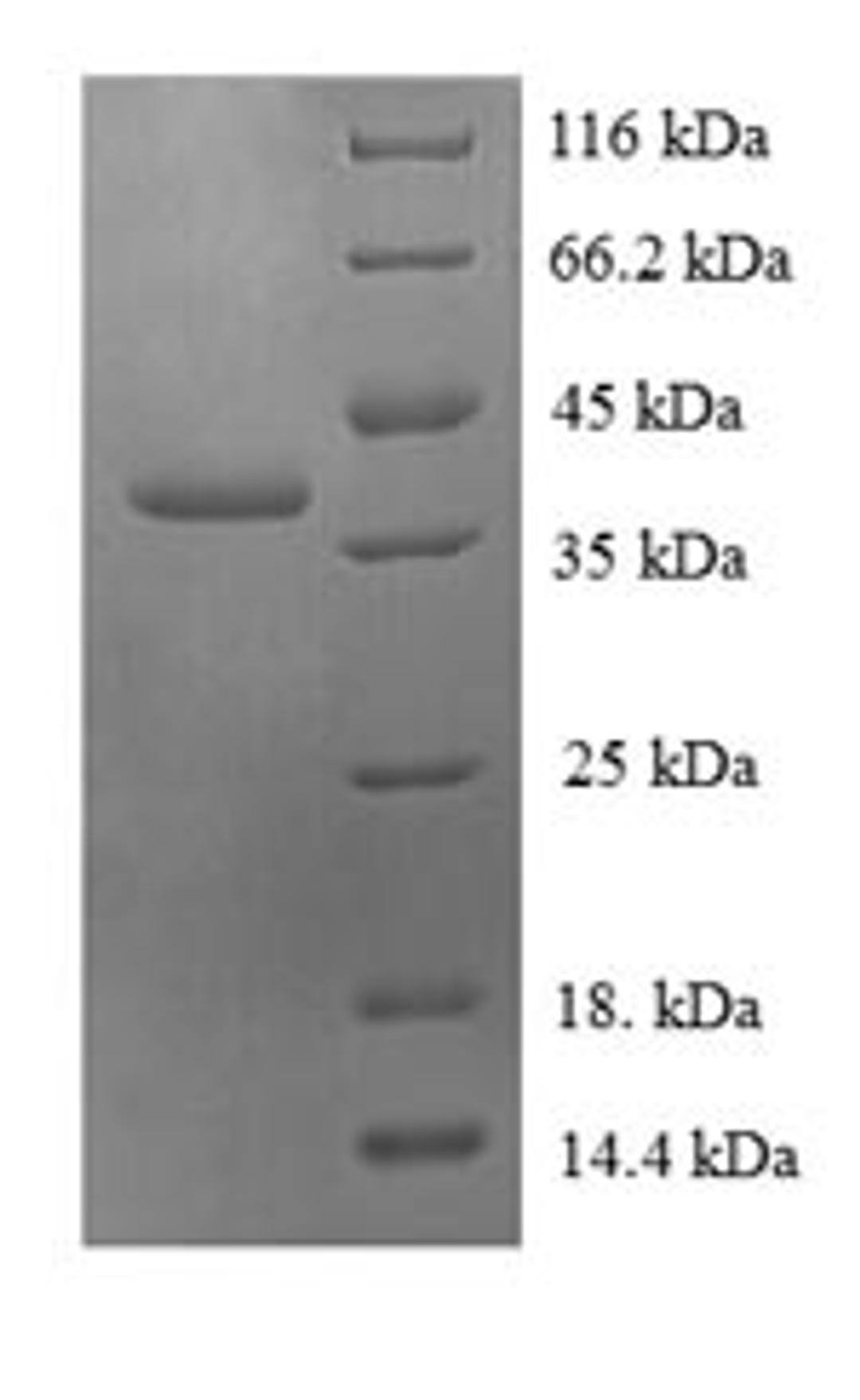 (Tris-Glycine gel) Discontinuous SDS-PAGE (reduced) with 5% enrichment gel and 15% separation gel.