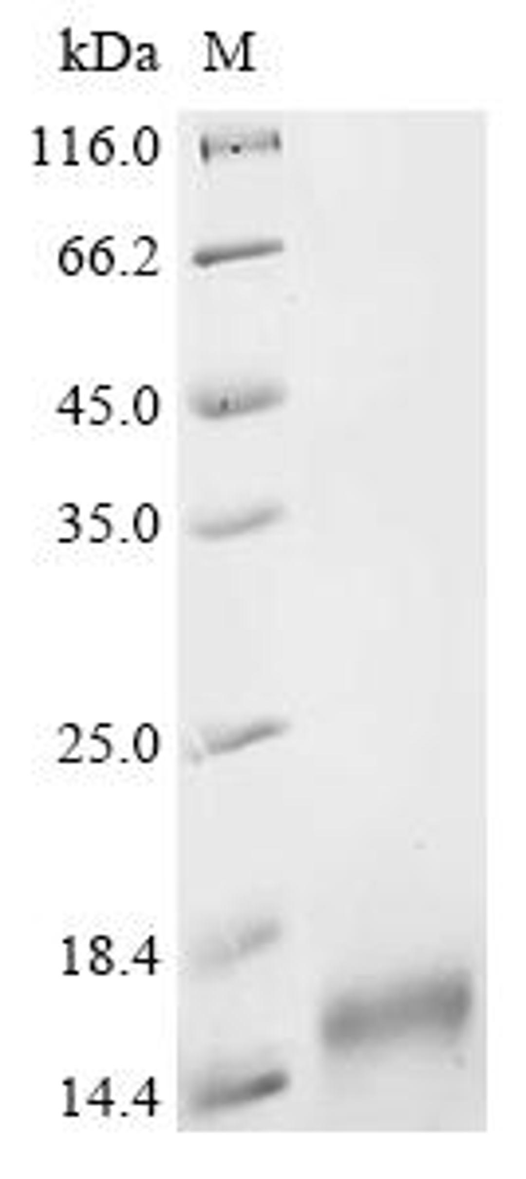 (Tris-Glycine gel) Discontinuous SDS-PAGE (reduced) with 5% enrichment gel and 15% separation gel.