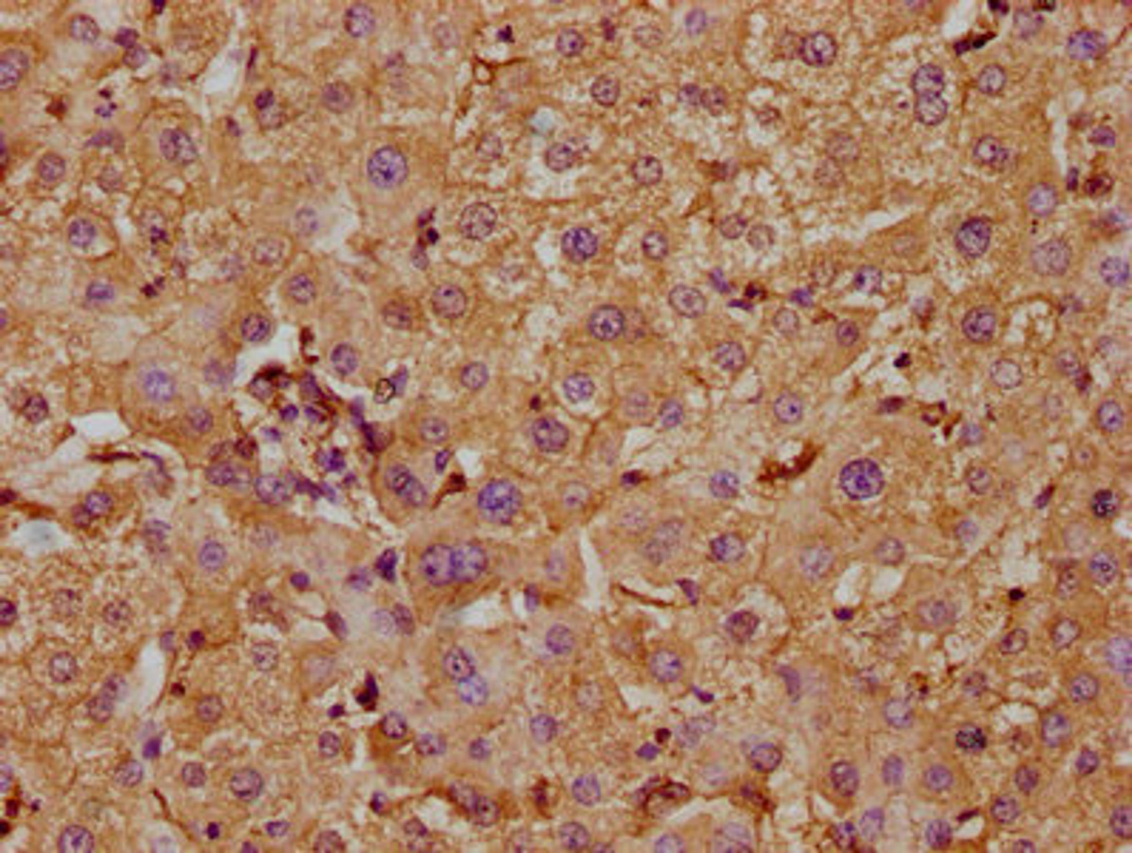 IHC image of CSB-PA752101LA01HU diluted at 1:300 and staining in paraffin-embedded human liver tissue performed on a Leica BondTM system. After dewaxing and hydration, antigen retrieval was mediated by high pressure in a citrate buffer (pH 6.0). Section was blocked with 10% normal goat serum 30min at RT. Then primary antibody (1% BSA) was incubated at 4°C overnight. The primary is detected by a biotinylated secondary antibody and visualized using an HRP conjugated SP system.