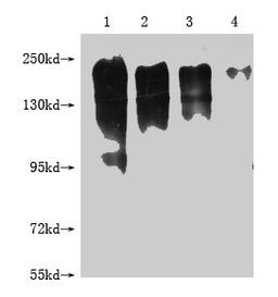 Western Blot. Positive WB detected in: 1-4 lanes: 293T whole cell lysate transfected with MERTK at 10ug, 5ug, 2.5ug, 1.25ug. All lanes: MERTK antibody at 1:2000. Secondary. Goat polyclonal to mouse IgG at 1/50000 dilution. Predicted band size: 150-250 KDa. Observed band size: 150-250 KDa. Exposure time：5S