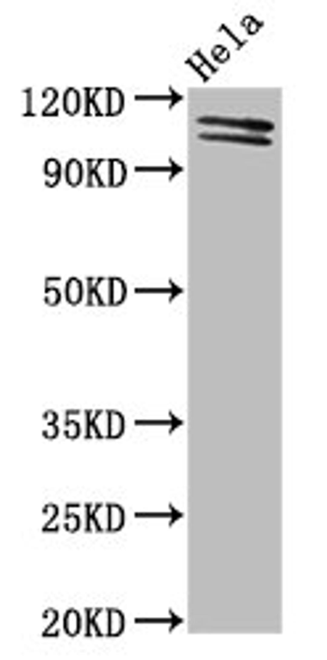 Western Blot. Positive WB detected in: Hela whole cell lysate. All lanes: UBA1 antibody at 2µg/ml. Secondary. Goat polyclonal to rabbit IgG at 1/50000 dilution. Predicted band size: 118, 114 kDa. Observed band size: 118, 114 kDa