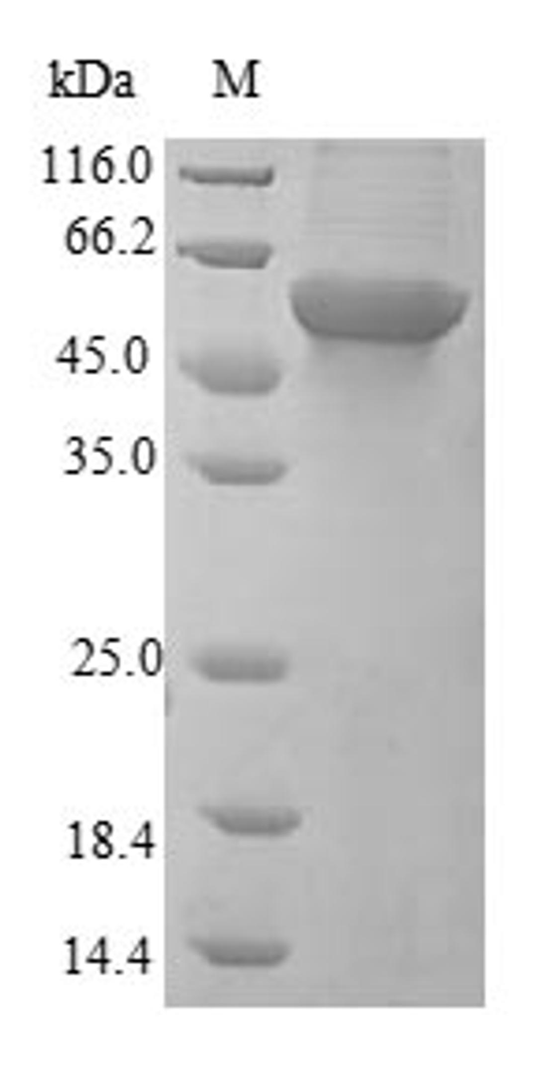 (Tris-Glycine gel) Discontinuous SDS-PAGE (reduced) with 5% enrichment gel and 15% separation gel.
