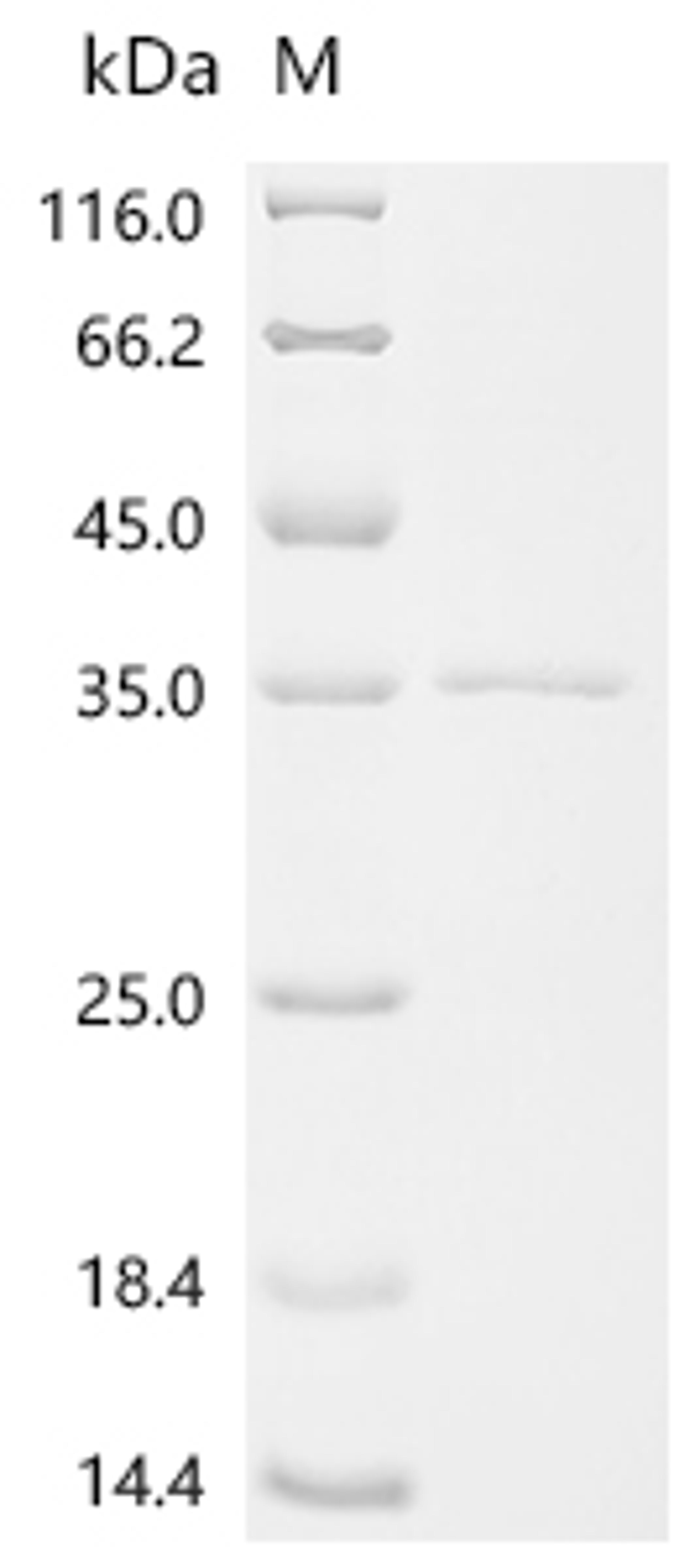 (Tris-Glycine gel) Discontinuous SDS-PAGE (reduced) with 5% enrichment gel and 15% separation gel.