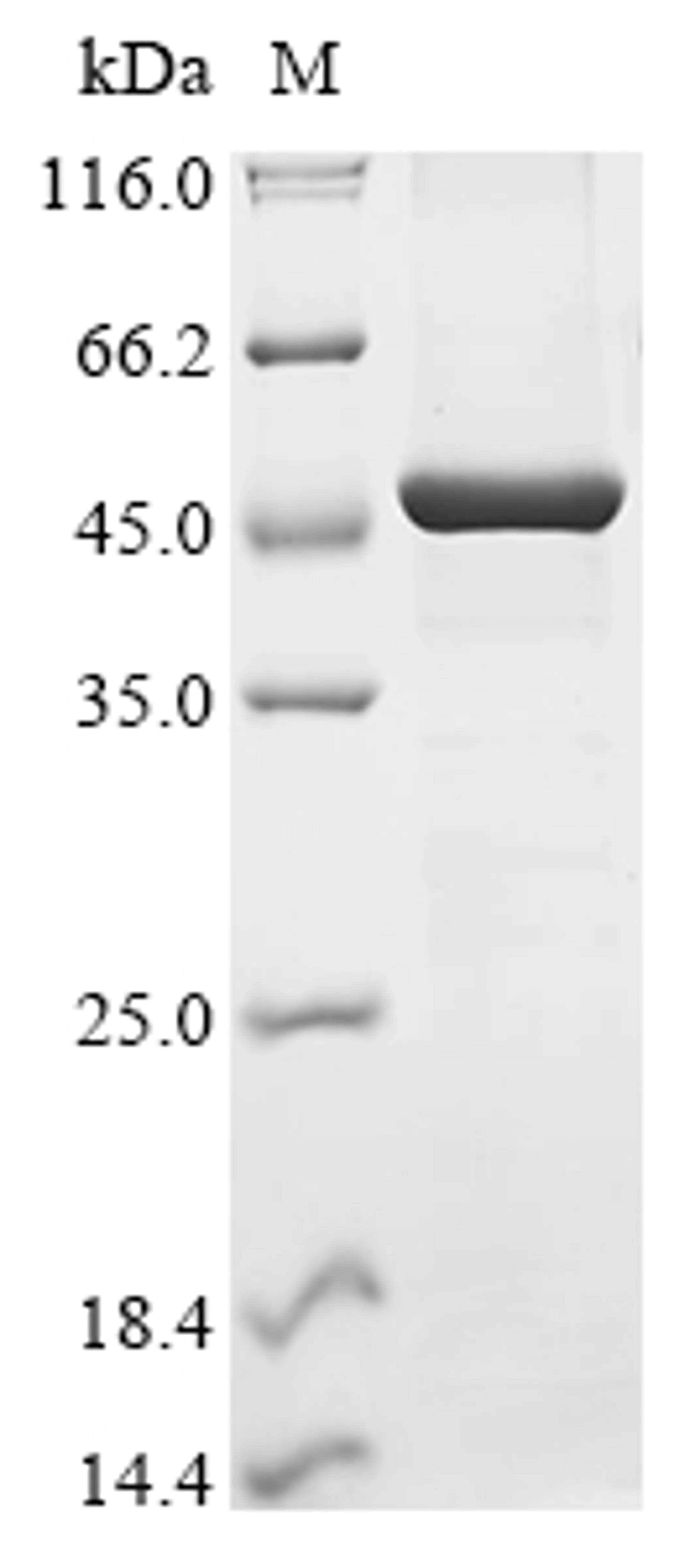 (Tris-Glycine gel) Discontinuous SDS-PAGE (reduced) with 5% enrichment gel and 15% separation gel.
