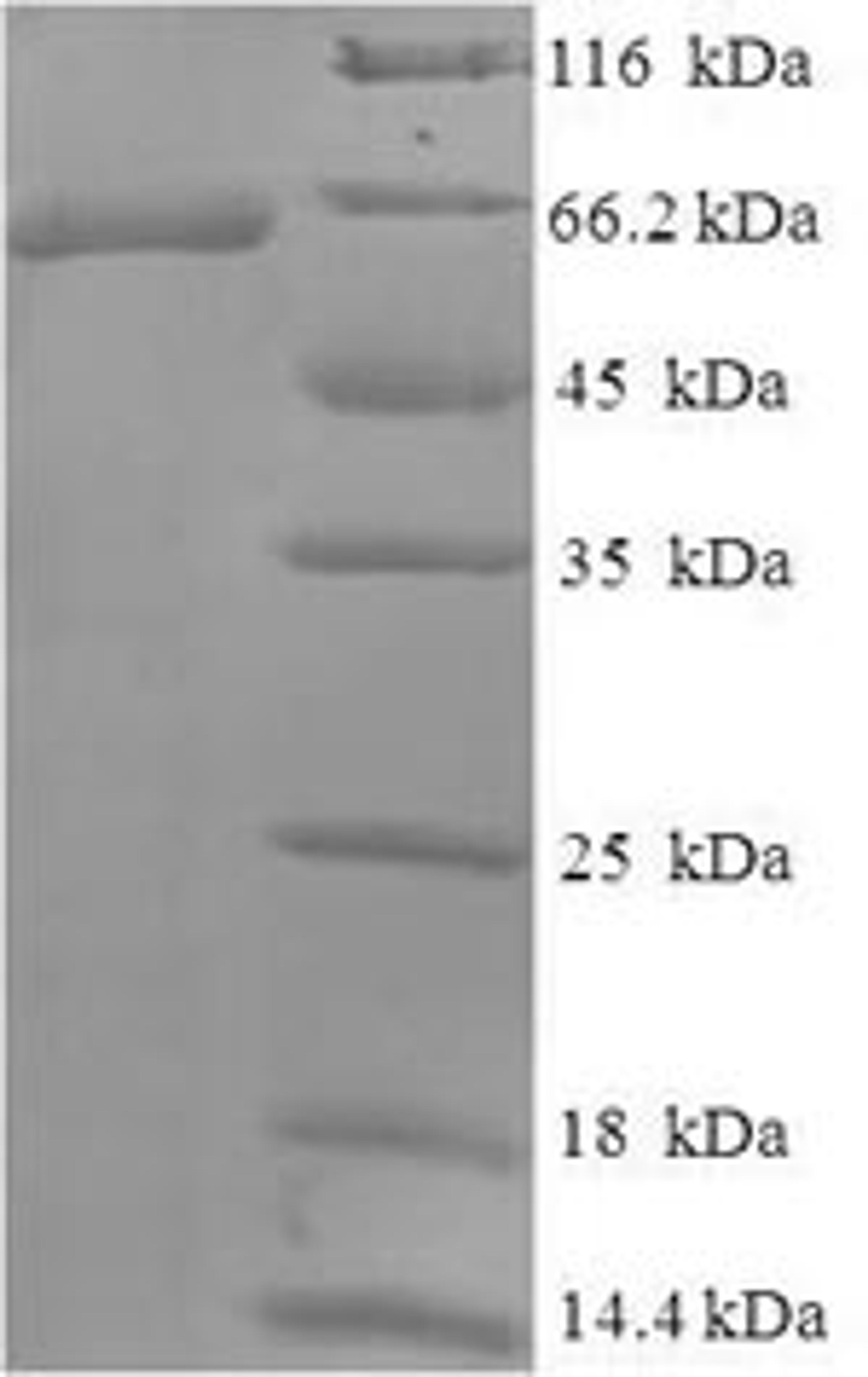 (Tris-Glycine gel) Discontinuous SDS-PAGE (reduced) with 5% enrichment gel and 15% separation gel.