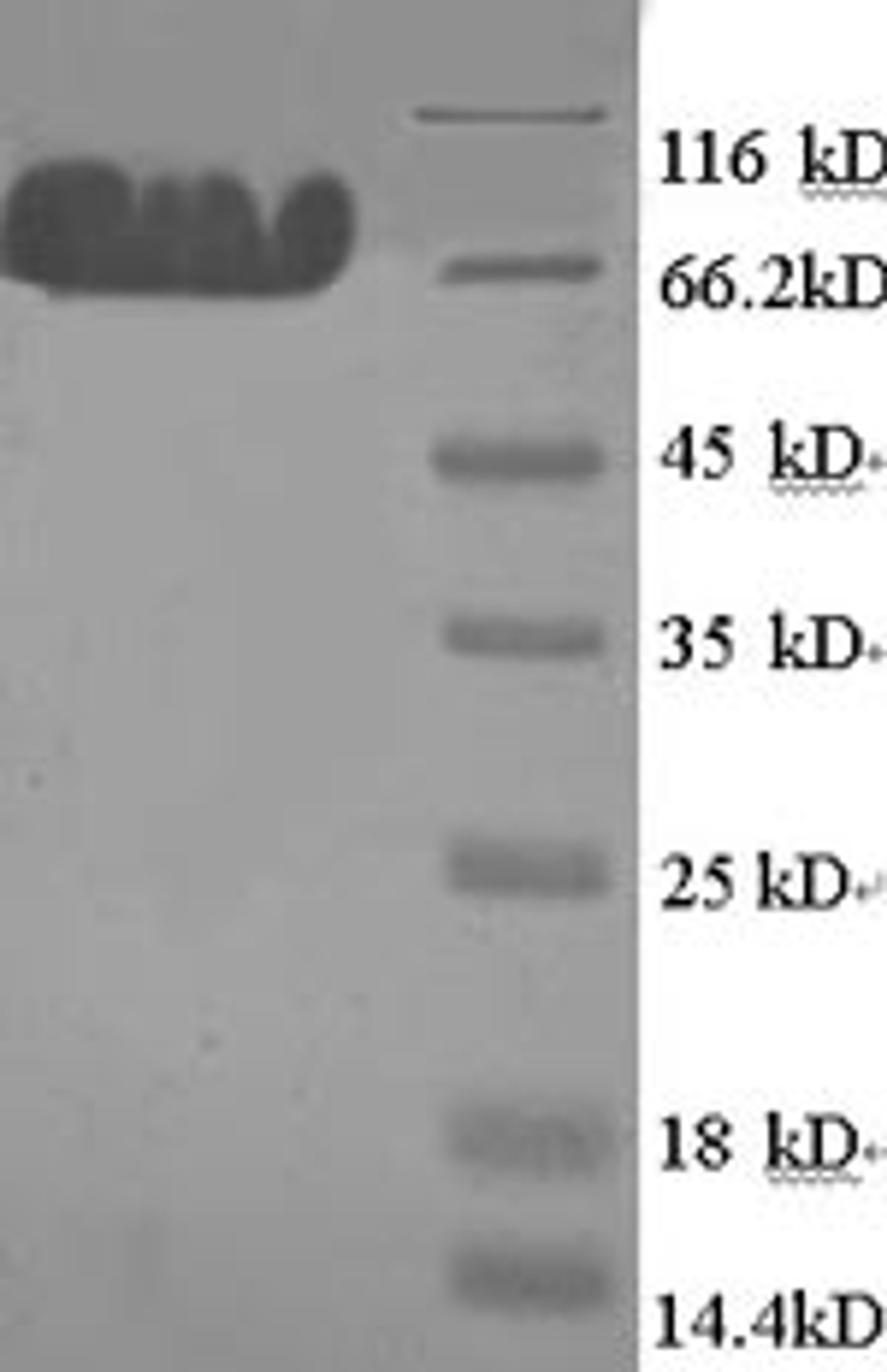 (Tris-Glycine gel) Discontinuous SDS-PAGE (reduced) with 5% enrichment gel and 15% separation gel.