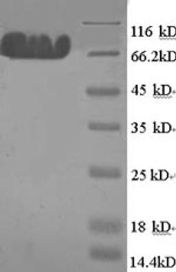 (Tris-Glycine gel) Discontinuous SDS-PAGE (reduced) with 5% enrichment gel and 15% separation gel.