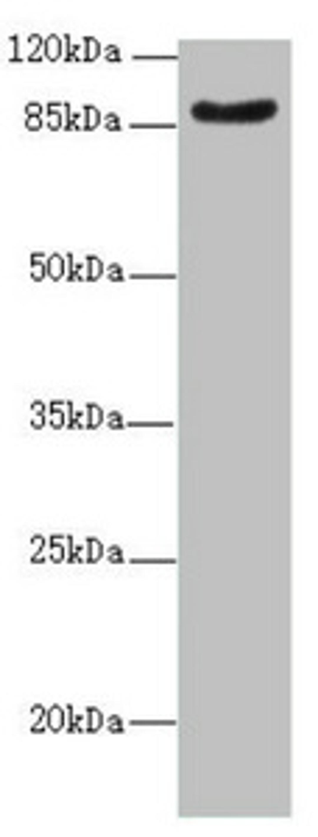 Western blot. All lanes: SUPT20H antibody at 2.07ug/ml + Mouse kidney tissue. Secondary. Goat polyclonal to rabbit IgG at 1/10000 dilution. Predicted band size: 86, 81, 89 kDa. Observed band size: 86 kDa. 