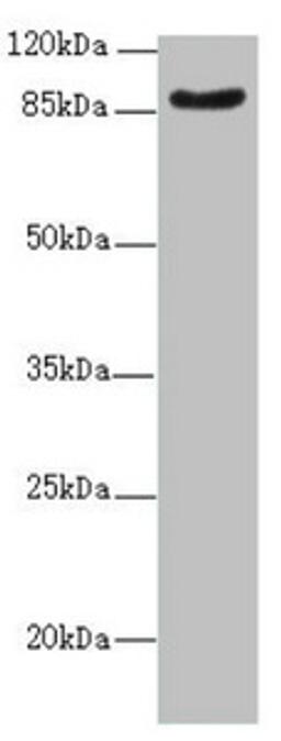 Western blot. All lanes: SUPT20H antibody at 2.07ug/ml + Mouse kidney tissue. Secondary. Goat polyclonal to rabbit IgG at 1/10000 dilution. Predicted band size: 86, 81, 89 kDa. Observed band size: 86 kDa. 