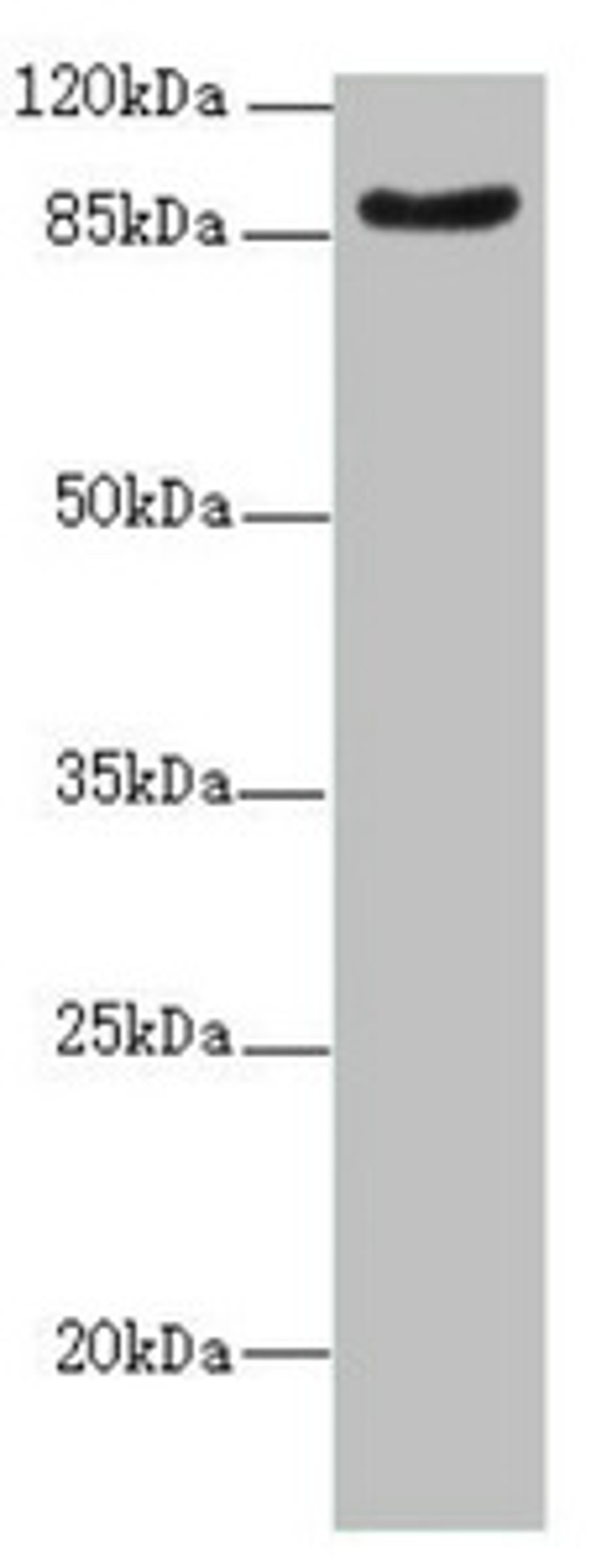 Western blot. All lanes: SUPT20H antibody at 2.07ug/ml + Mouse kidney tissue. Secondary. Goat polyclonal to rabbit IgG at 1/10000 dilution. Predicted band size: 86, 81, 89 kDa. Observed band size: 86 kDa. 