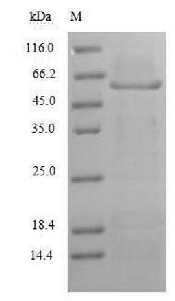 (Tris-Glycine gel) Discontinuous SDS-PAGE (reduced) with 5% enrichment gel and 15% separation gel.
