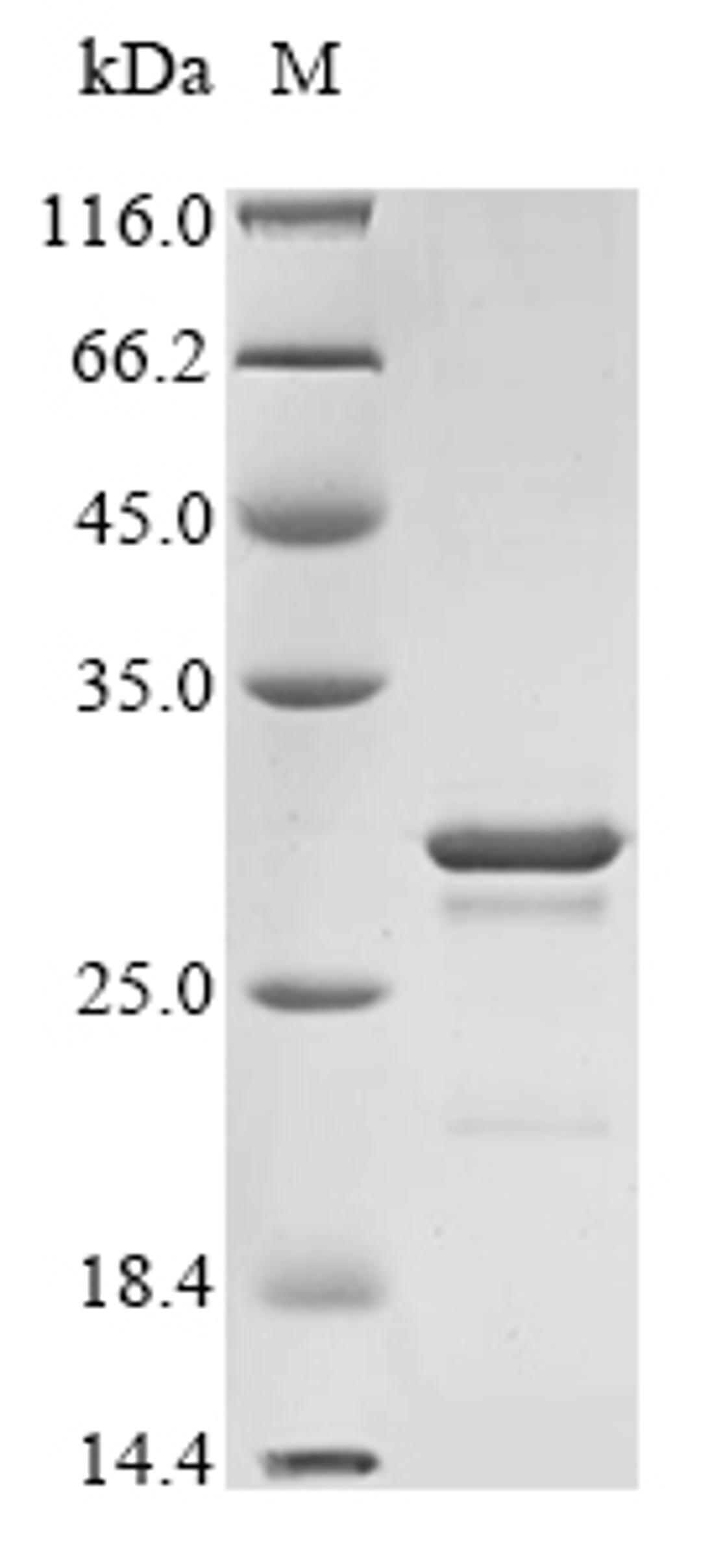 (Tris-Glycine gel) Discontinuous SDS-PAGE (reduced) with 5% enrichment gel and 15% separation gel.