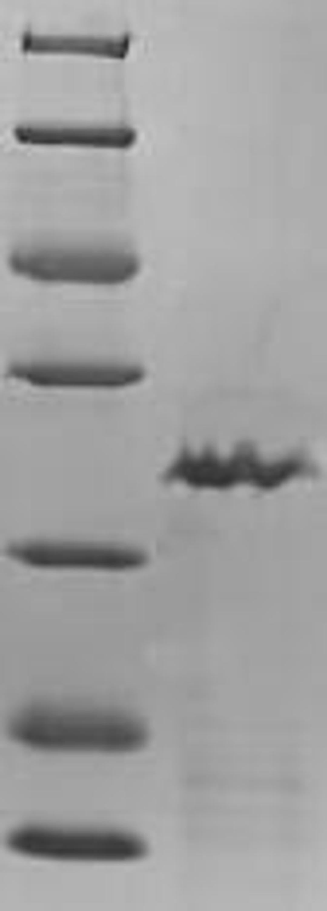 (Tris-Glycine gel) Discontinuous SDS-PAGE (reduced) with 5% enrichment gel and 15% separation gel.