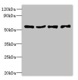 Western blot. All lanes: UBA5 antibody at 6ug/ml. Lane 1: Jurkat whole cell lysate. Lane 2: Hela whole cell lysate. Lane 3: HepG2 whole cell lysate. Lane 4: Caco-2 whole cell lysate. Secondary. Goat polyclonal to rabbit IgG at 1/10000 dilution. Predicted band size: 45, 39 kDa. Observed band size: 45 kDa. 