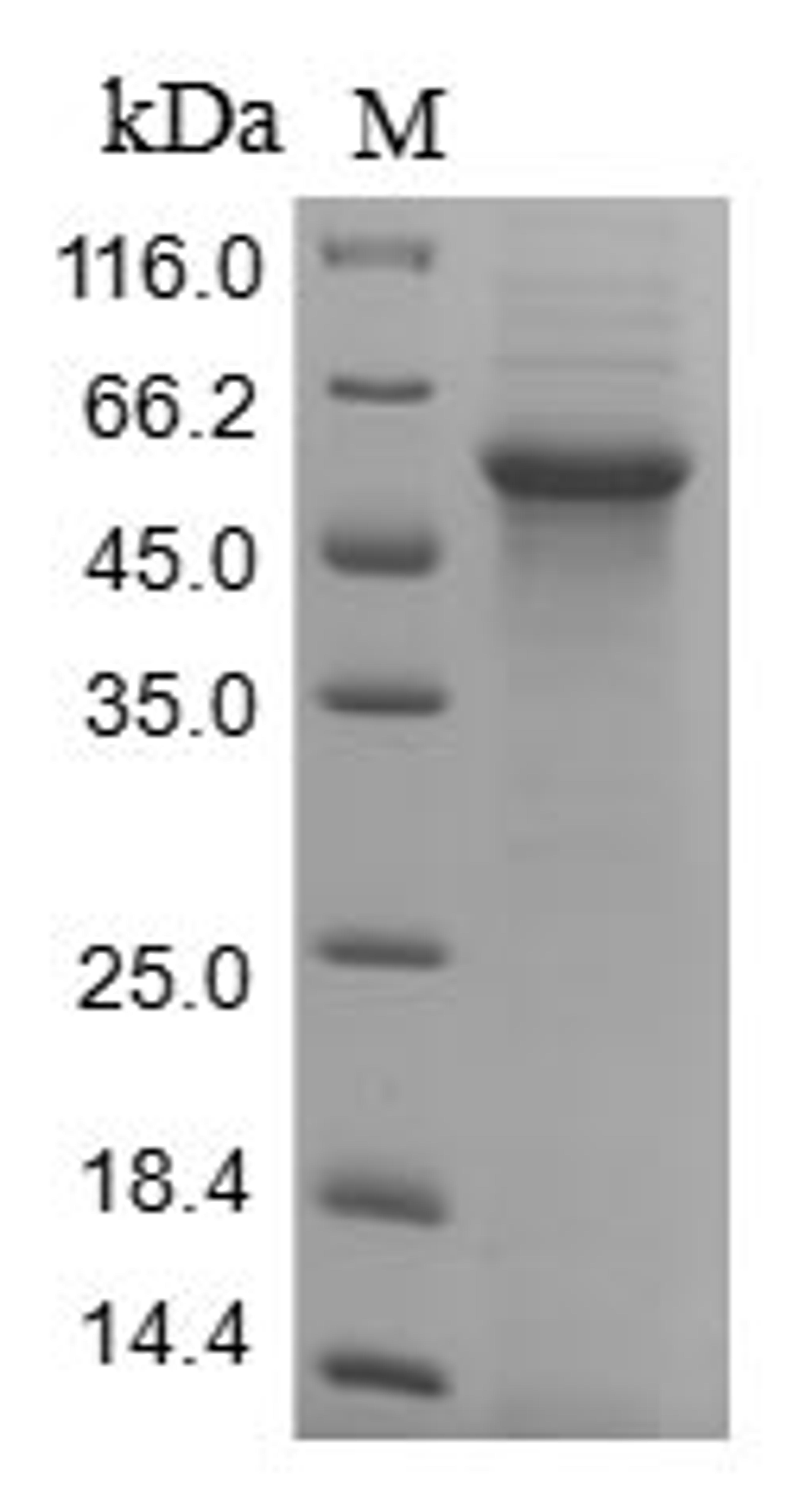 (Tris-Glycine gel) Discontinuous SDS-PAGE (reduced) with 5% enrichment gel and 15% separation gel.