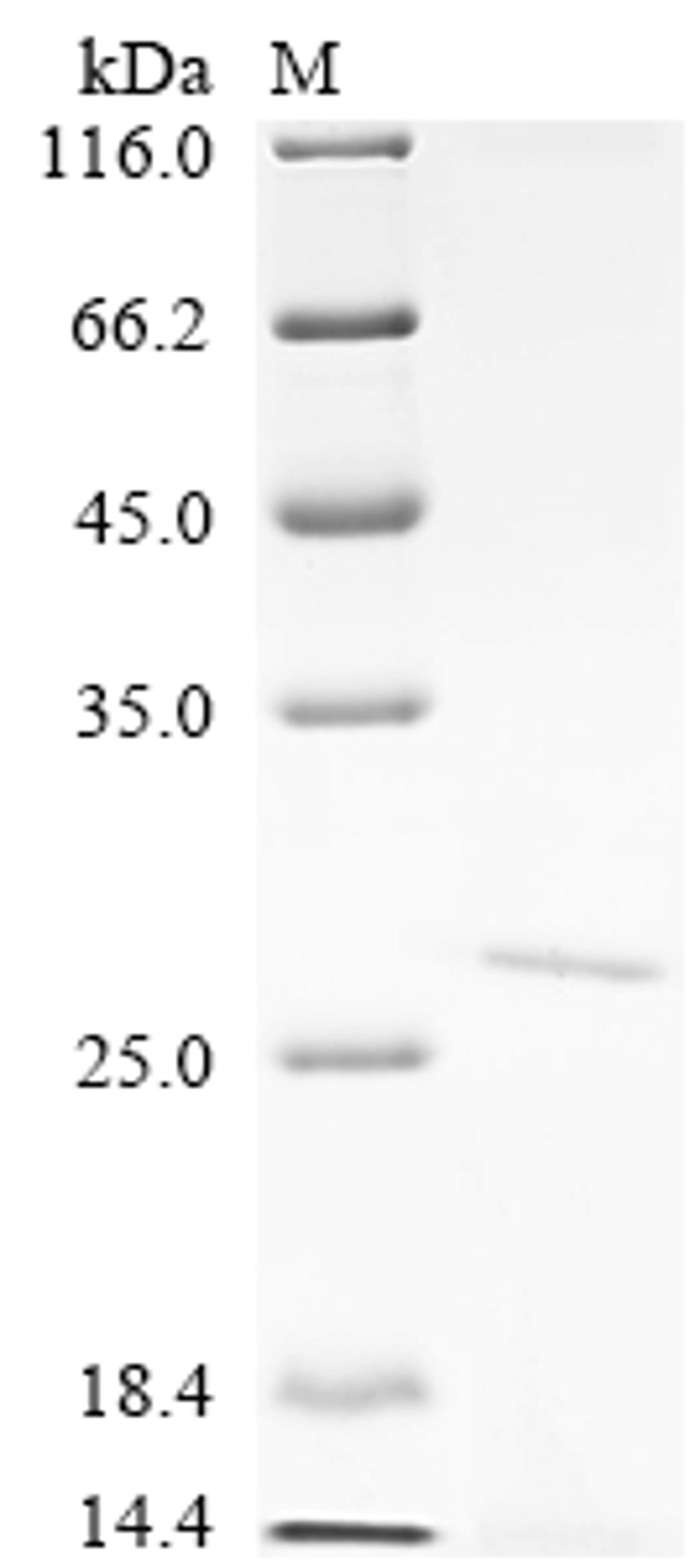 (Tris-Glycine gel) Discontinuous SDS-PAGE (reduced) with 5% enrichment gel and 15% separation gel.