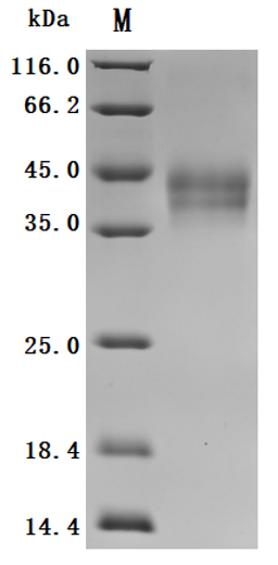(Tris-Glycine gel) Discontinuous SDS-PAGE (reduced) with 5% enrichment gel and 15% separation gel.