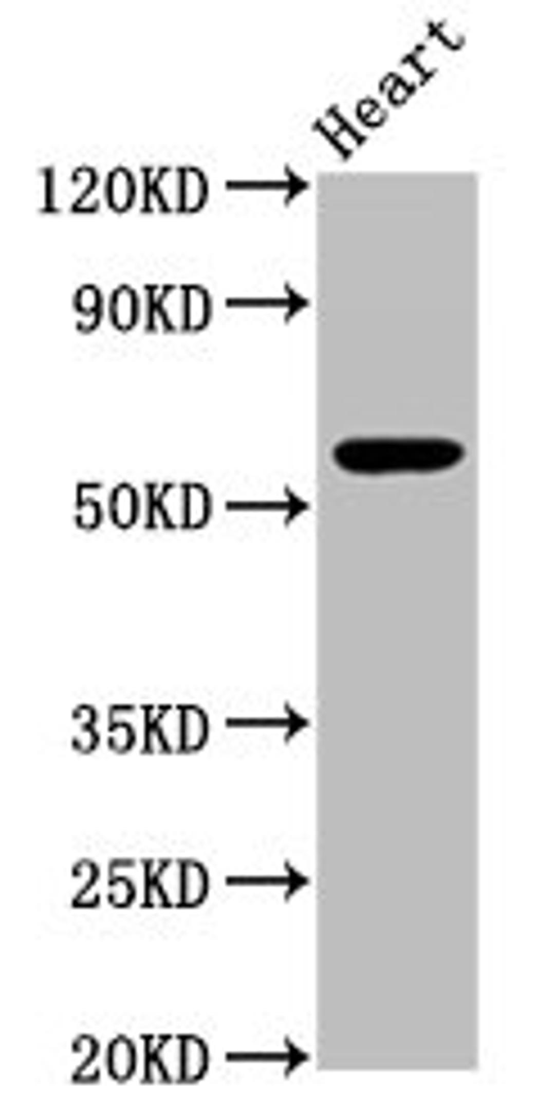 Western Blot. Positive WB detected in: Mouse heart tissue. All lanes: PSAP antibody at 3.3µg/ml. Secondary. Goat polyclonal to rabbit IgG at 1/50000 dilution. Predicted band size: 59 kDa. Observed band size: 59 kDa