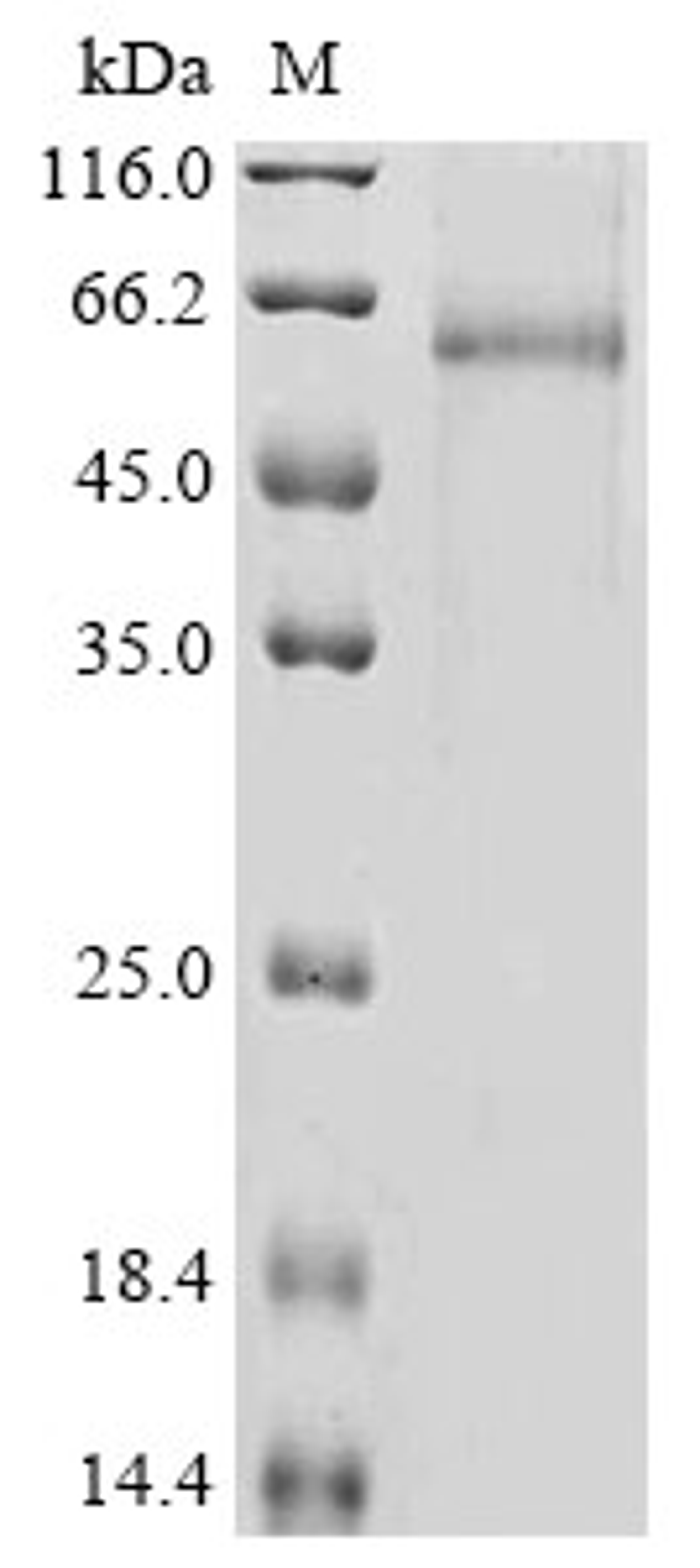 (Tris-Glycine gel) Discontinuous SDS-PAGE (reduced) with 5% enrichment gel and 15% separation gel.