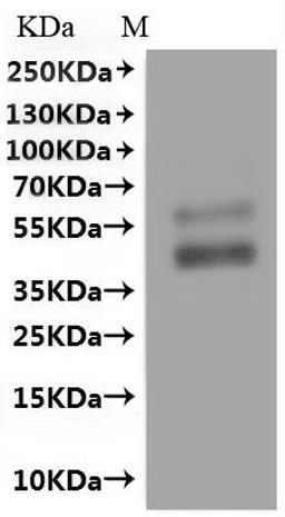 CSB-MP001391HU(A4) is detected by Mouse anti-6*His monoclonal antibody.