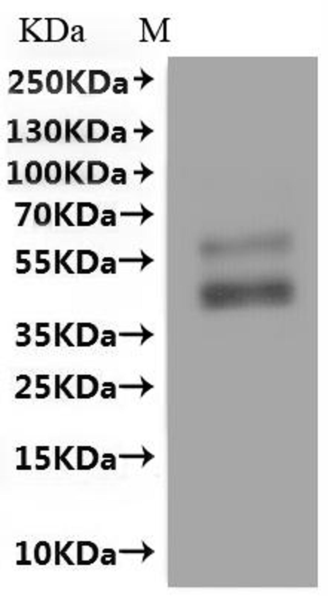 CSB-MP001391HU(A4) is detected by Mouse anti-6*His monoclonal antibody.