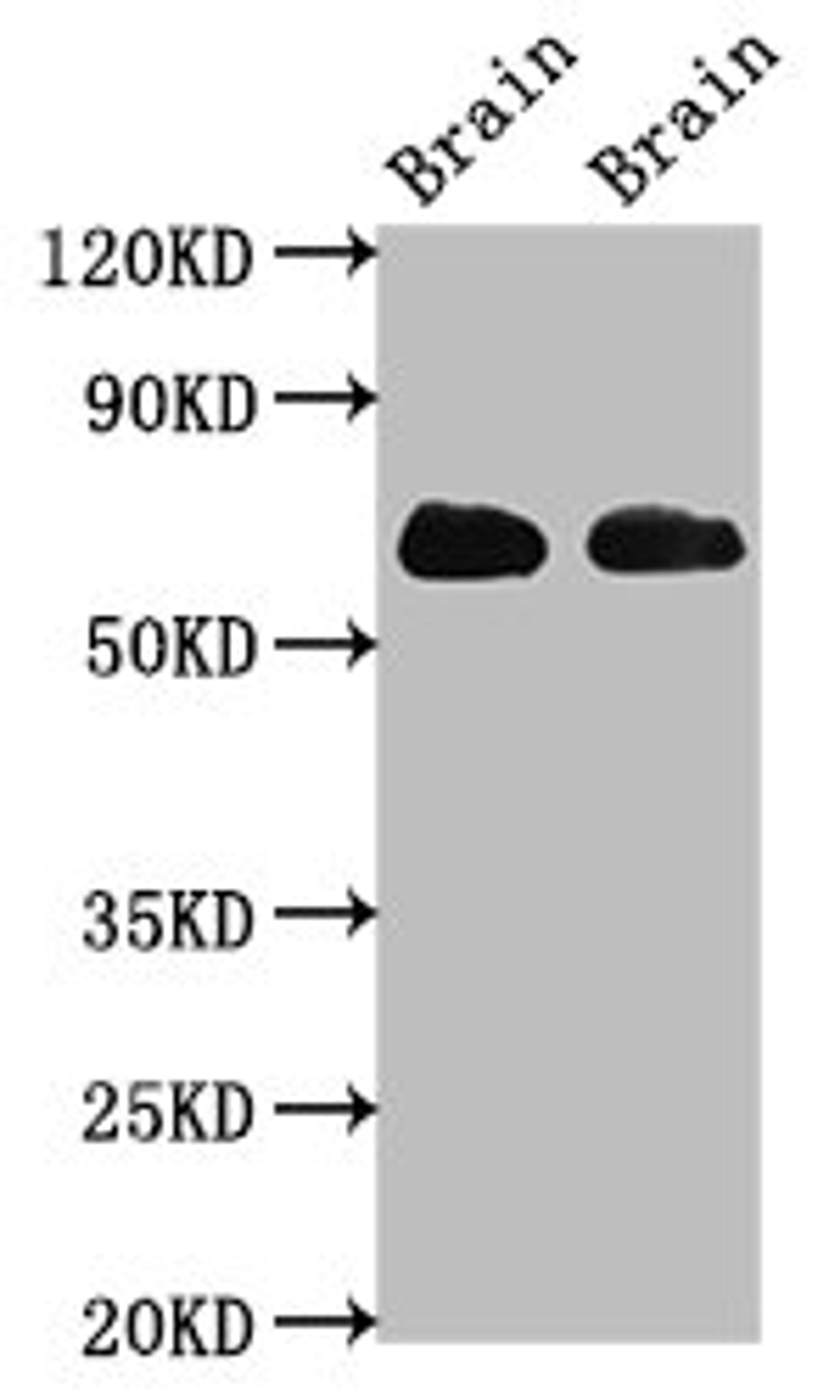 Western Blot. Positive WB detected in: Rat brain tissue, Mouse brain tissue. All lanes: SLC1A2 antibody at 3.2ug/ml. Secondary. Goat polyclonal to rabbit IgG at 1/50000 dilution. Predicted band size: 63, 62 kDa. Observed band size: 63 kDa. 