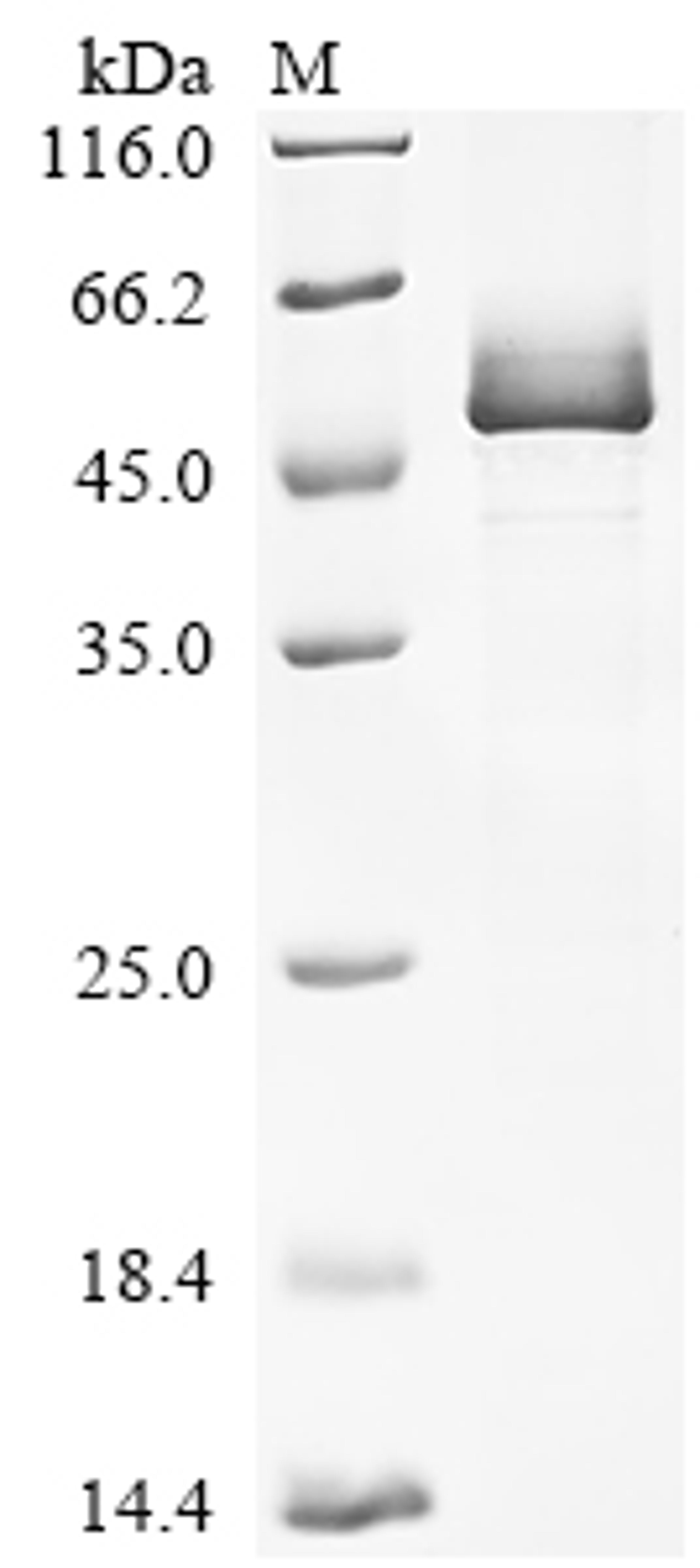 (Tris-Glycine gel) Discontinuous SDS-PAGE (reduced) with 5% enrichment gel and 15% separation gel.