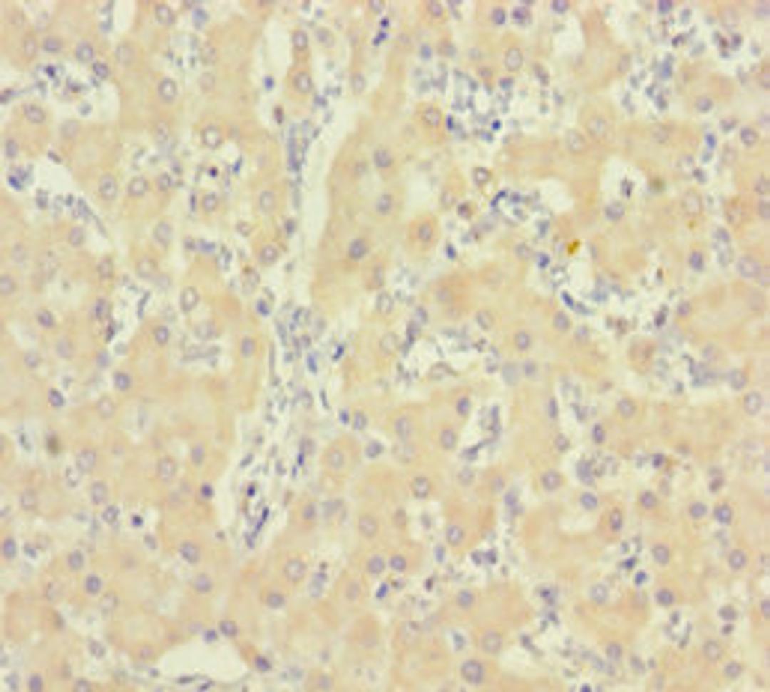 Immunohistochemistry of paraffin-embedded human liver tissue using CSB-PA010997LA01HU at dilution of 1:100
