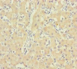 Immunohistochemistry of paraffin-embedded human liver tissue using CSB-PA010997LA01HU at dilution of 1:100