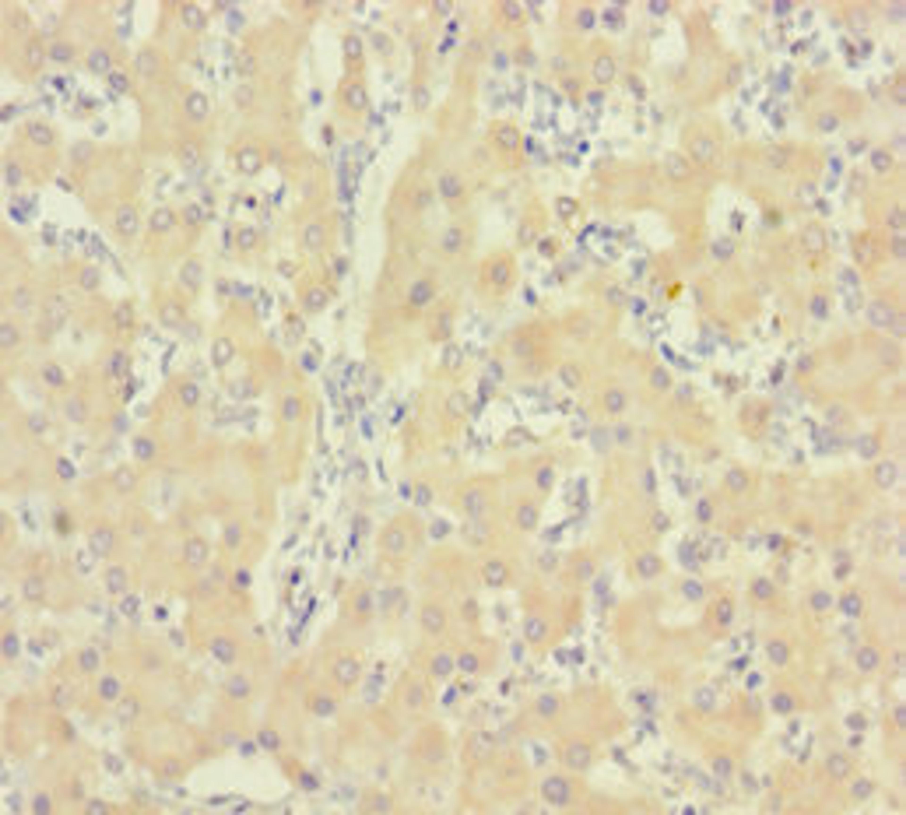 Immunohistochemistry of paraffin-embedded human liver tissue using CSB-PA010997LA01HU at dilution of 1:100
