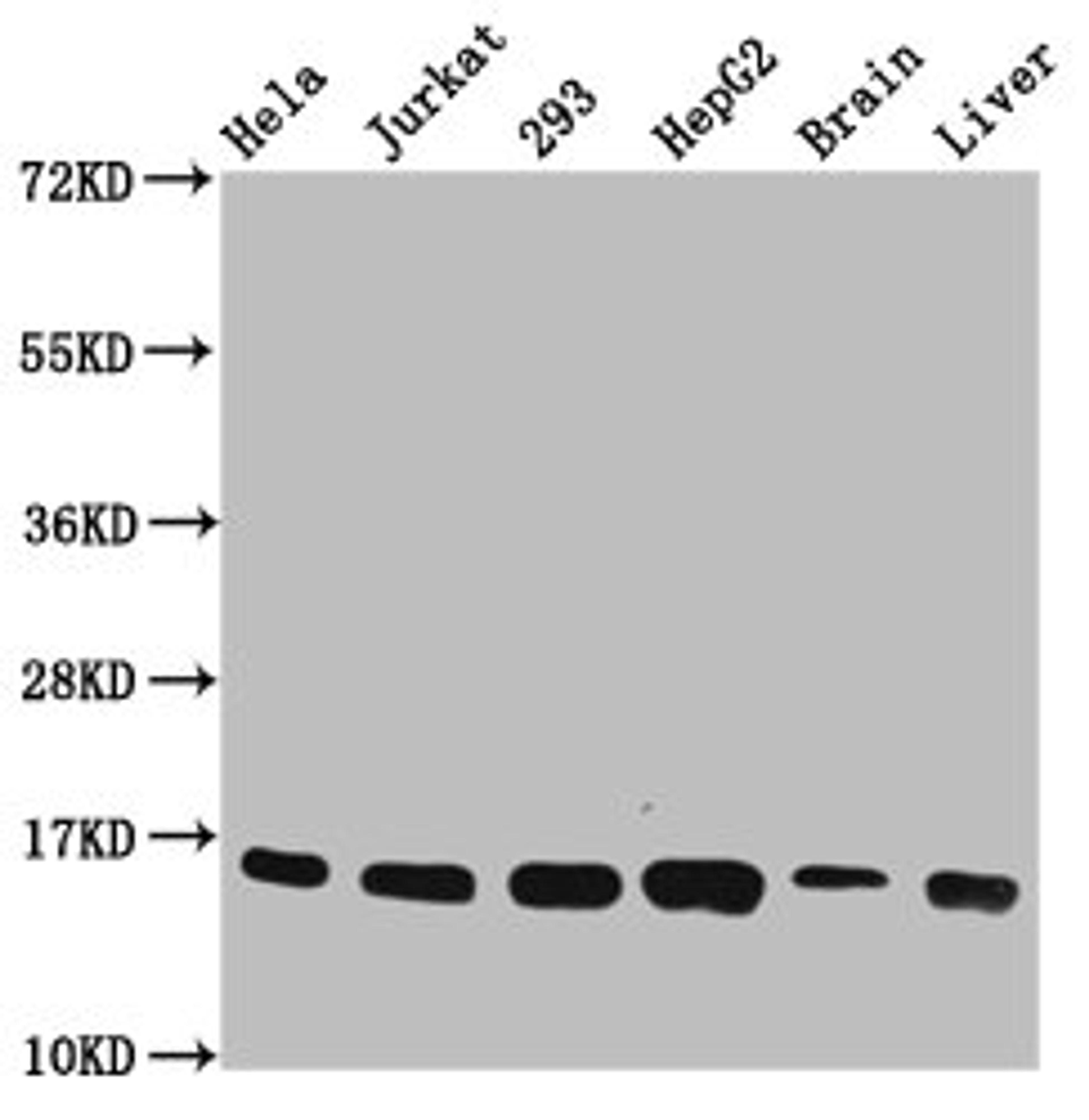 Western Blot. Positive WB detected in: Hela whole cell lysate, Jurkat whole cell lysate, 293 whole cell lysate, HepG2 whole cell lysate, Rat brain tissue, Rat liver tissue. All lanes: HIST1H3A antibody at 0.22µg/ml. Secondary. Goat polyclonal to rabbit IgG at 1/50000 dilution. Predicted band size: 16 kDa. Observed band size: 16 kDa