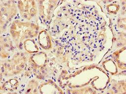Immunohistochemistry of paraffin-embedded human kidney tissue using CSB-PA853385LA01HU at dilution of 1:100