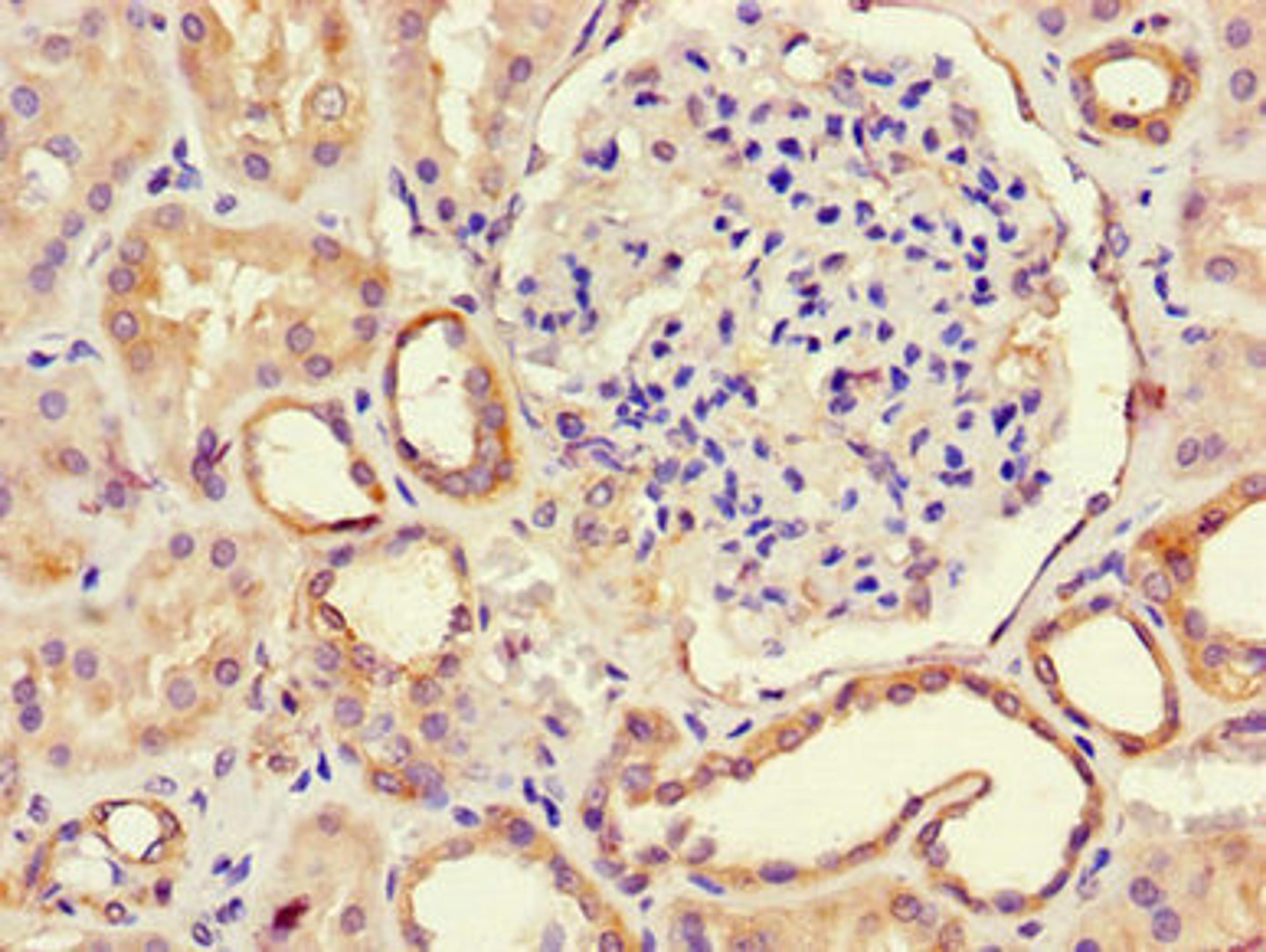 Immunohistochemistry of paraffin-embedded human kidney tissue using CSB-PA853385LA01HU at dilution of 1:100