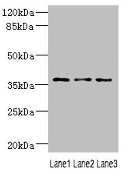 Western blot. All lanes: DNAJB2 antibody at 1.18ug/ml. Lane 1: 293T whole cell lysate. Lane 2: PC-3 whole cell lysate. Lane 3: A431 whole cell lysate. Secondary. Goat polyclonal to rabbit IgG at 1/10000 dilution. Predicted band size: 36, 31 kDa. Observed band size: 36 kDa. 