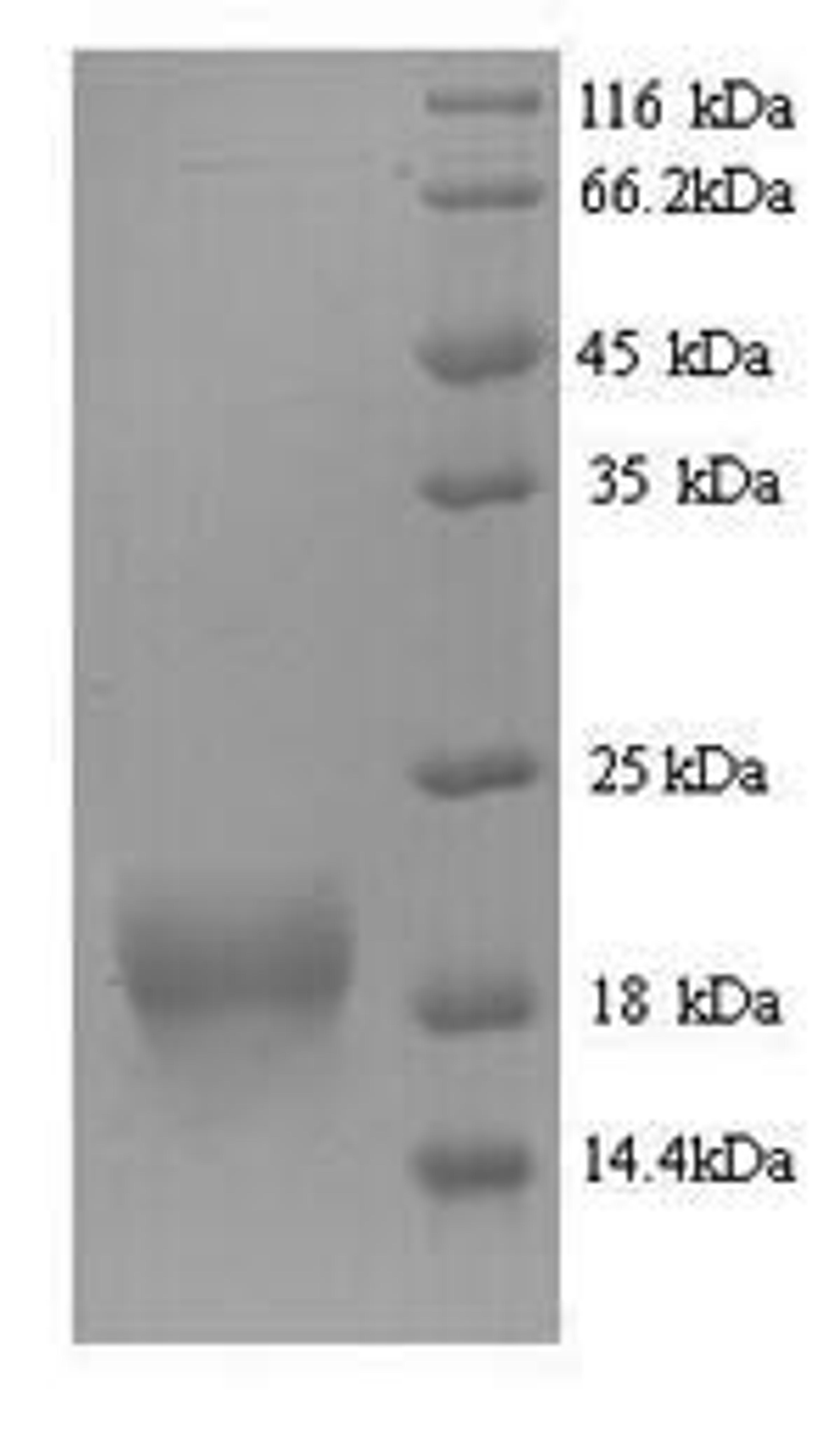 (Tris-Glycine gel) Discontinuous SDS-PAGE (reduced) with 5% enrichment gel and 15% separation gel.