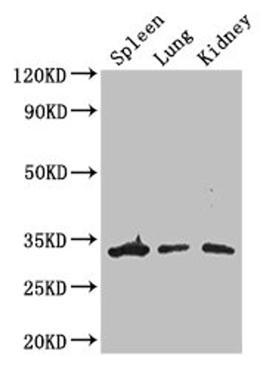 Western Blot. Positive WB detected in: Mouse spleen tissue, Mouse lung tissue, Mouse kidney tissue. All lanes: ALKBH4 antibody at 3ug/ml. Secondary. Goat polyclonal to rabbit IgG at 1/50000 dilution. Predicted band size: 34, 5 kDa. Observed band size: 34 kDa. 