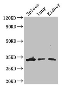 Western Blot. Positive WB detected in: Mouse spleen tissue, Mouse lung tissue, Mouse kidney tissue. All lanes: ALKBH4 antibody at 3ug/ml. Secondary. Goat polyclonal to rabbit IgG at 1/50000 dilution. Predicted band size: 34, 5 kDa. Observed band size: 34 kDa. 
